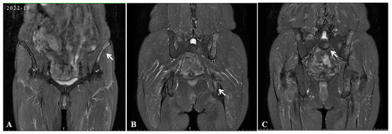 Diagnostics 15 01135 g002