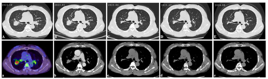 Diagnostics 15 01135 g004