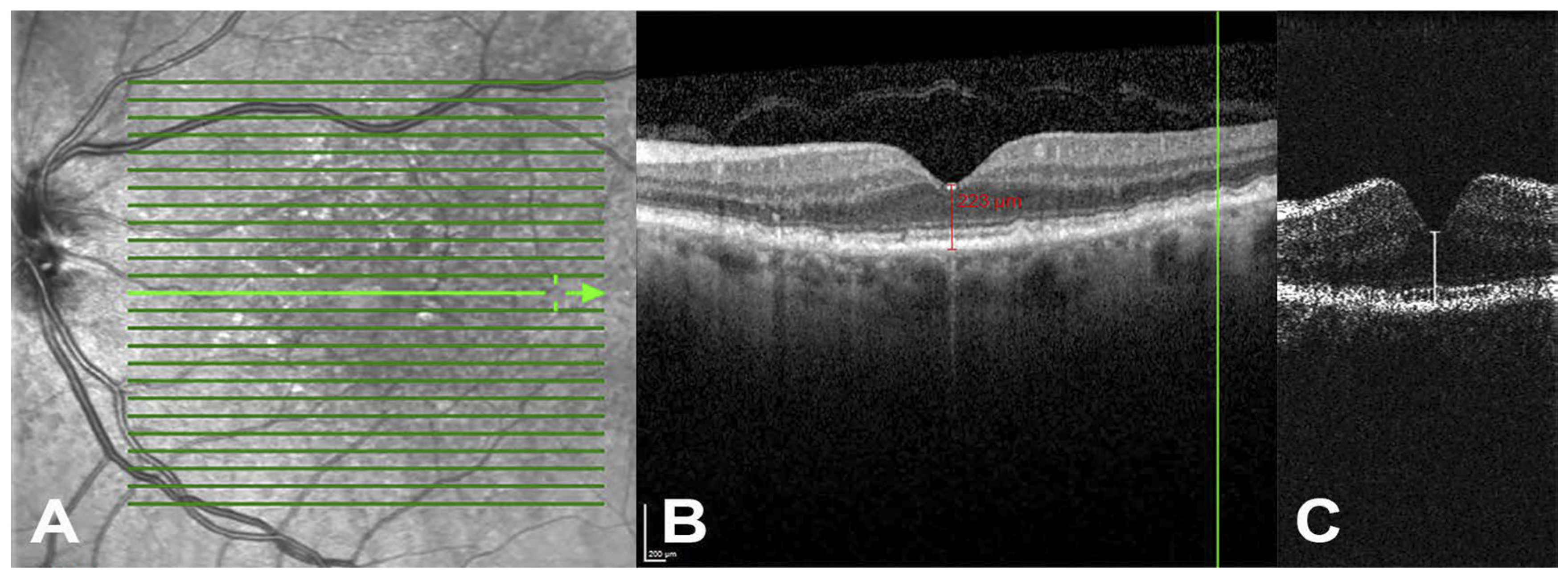 Diagnostics 15 01140 g004