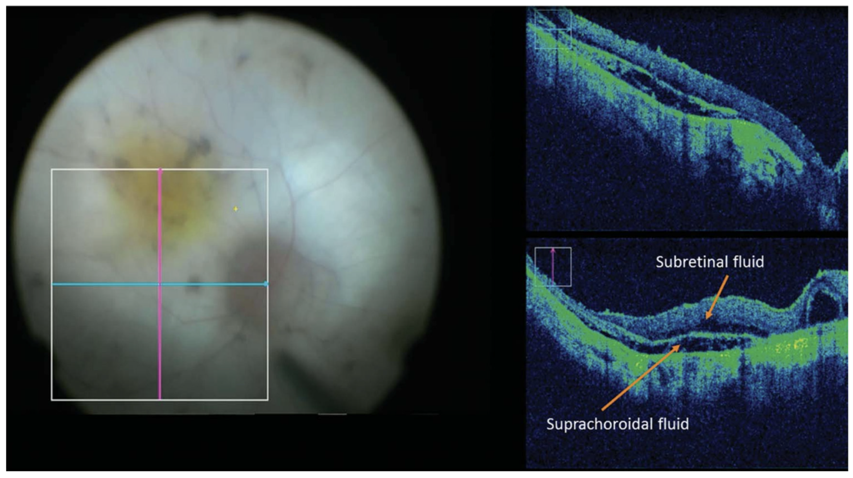 Diagnostics 15 01140 g008