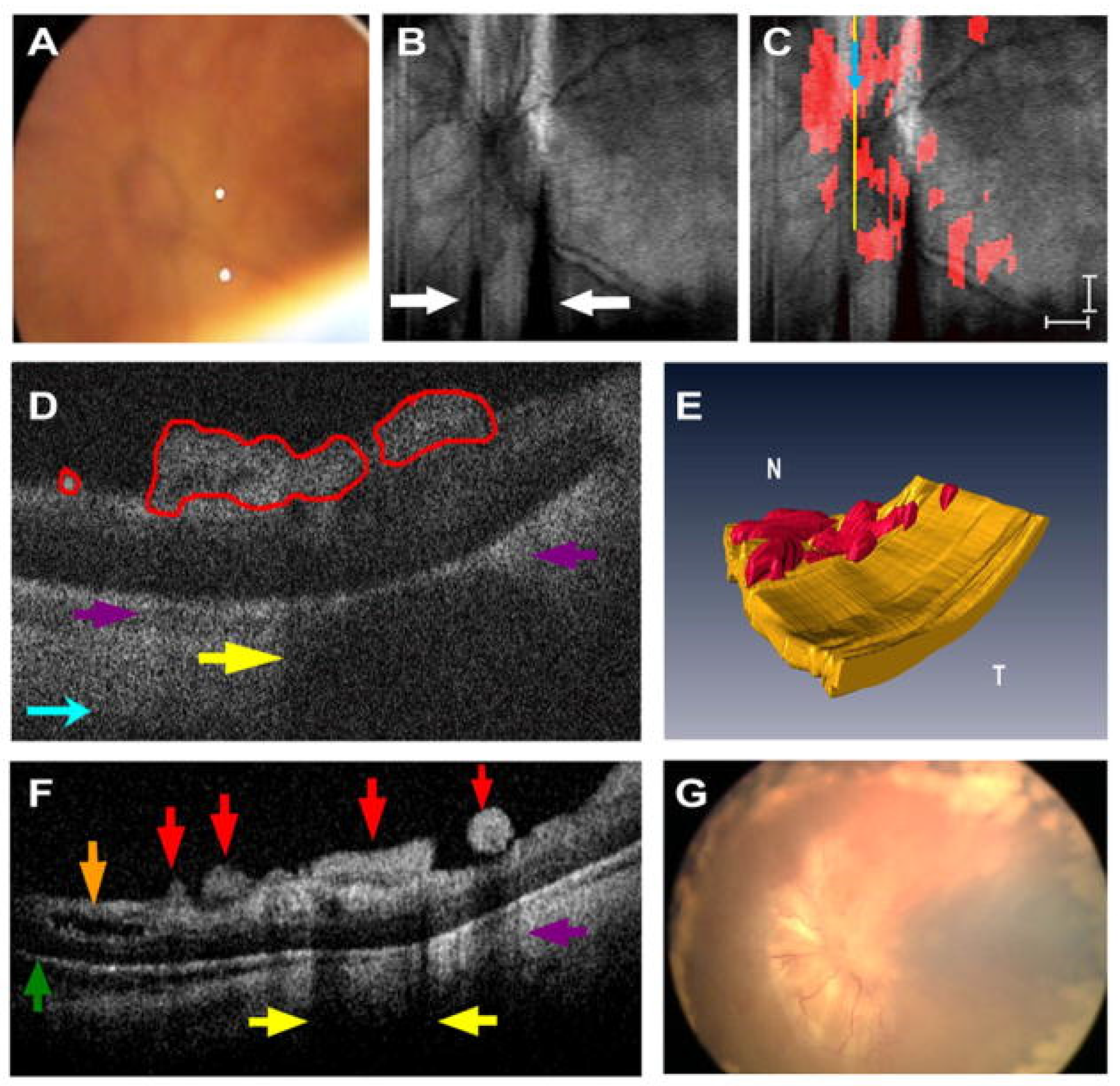 Diagnostics 15 01140 g009
