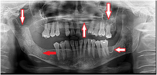Diagnostics 15 01158 g001