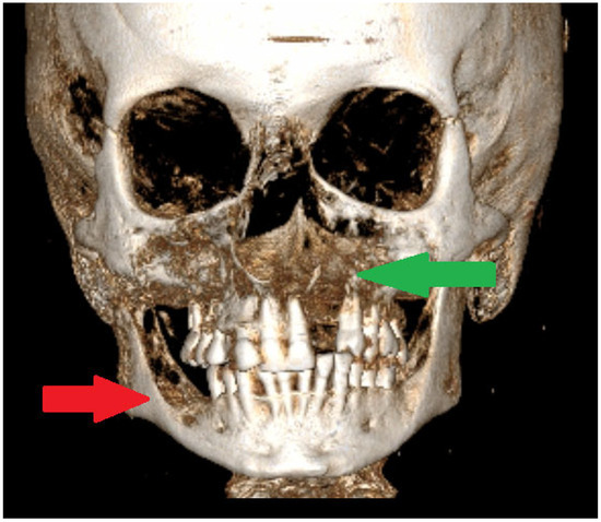 Diagnostics 15 01158 g002