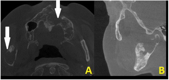 Diagnostics 15 01158 g003
