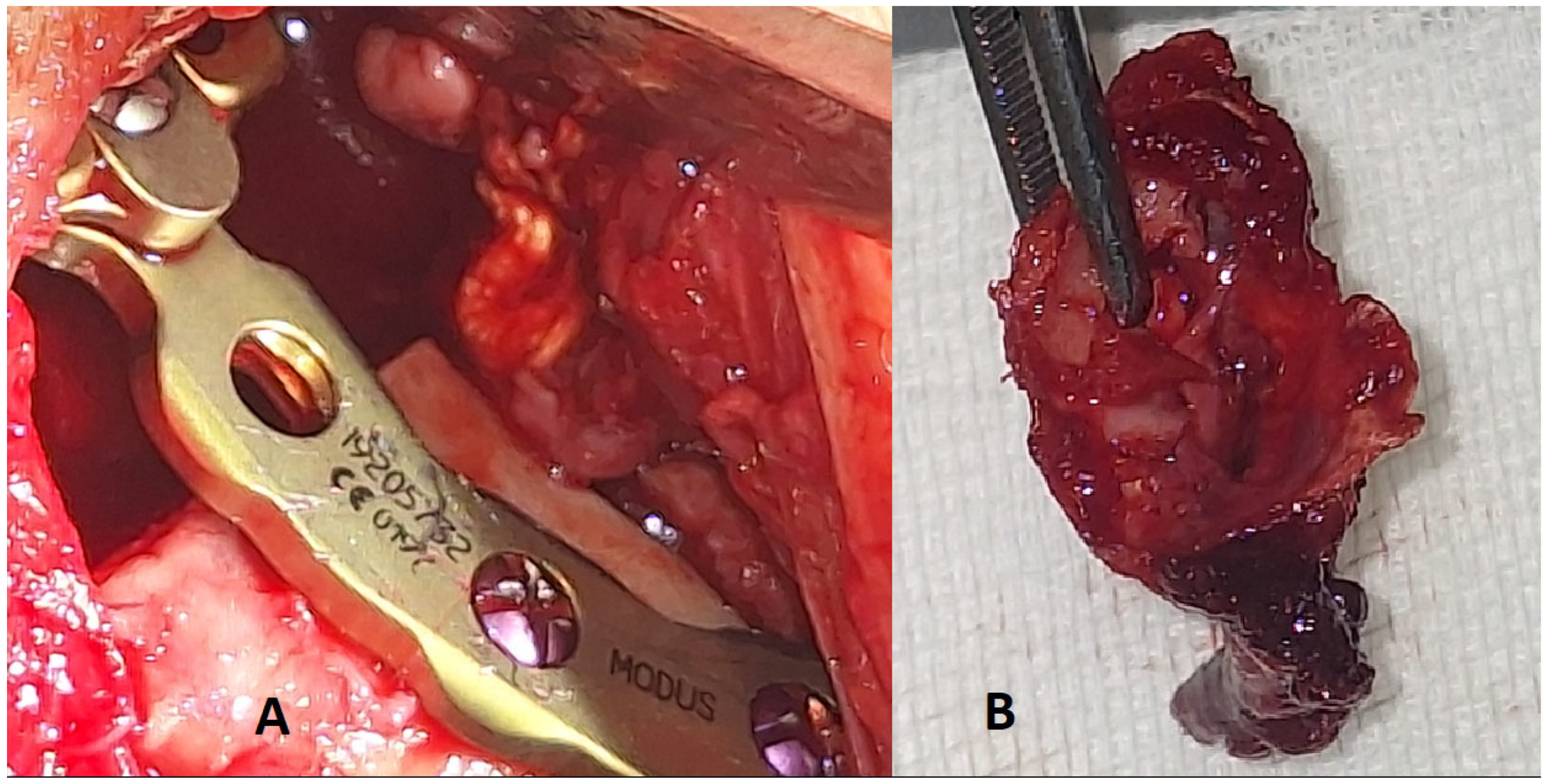 Diagnostics 15 01158 g005
