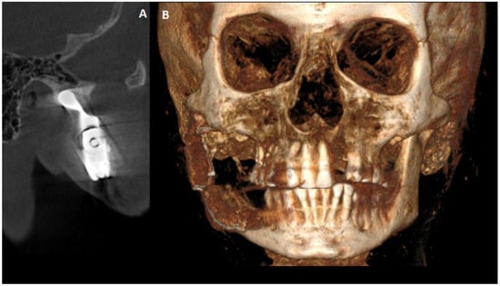 Diagnostics 15 01158 g007