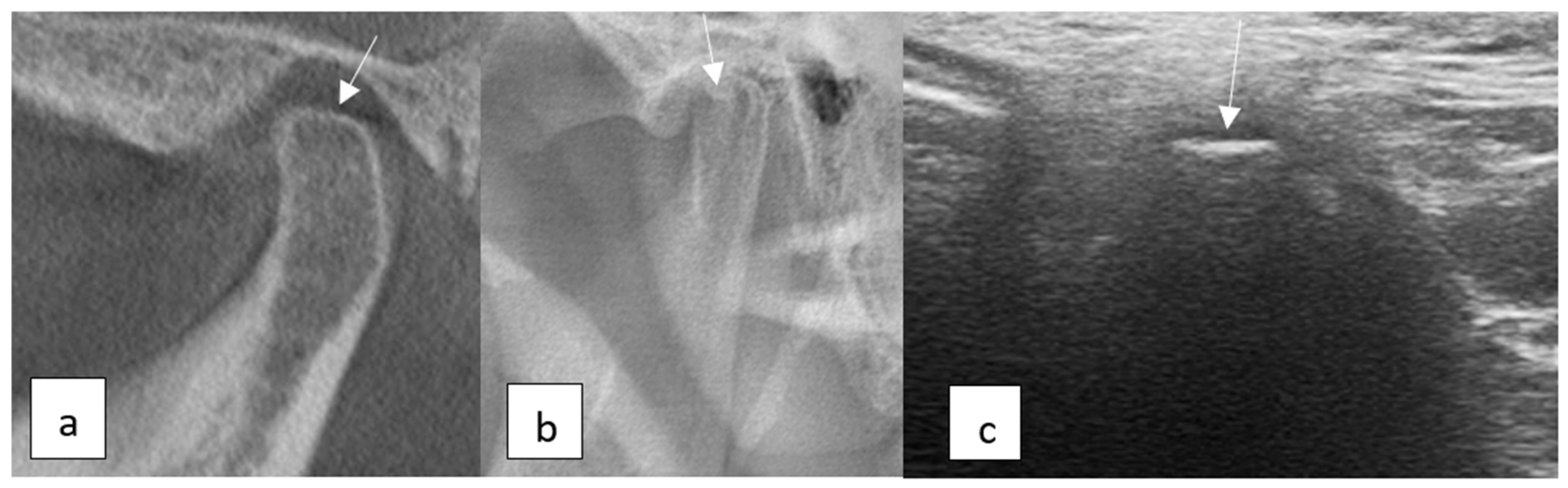 Diagnostics 15 01160 g003
