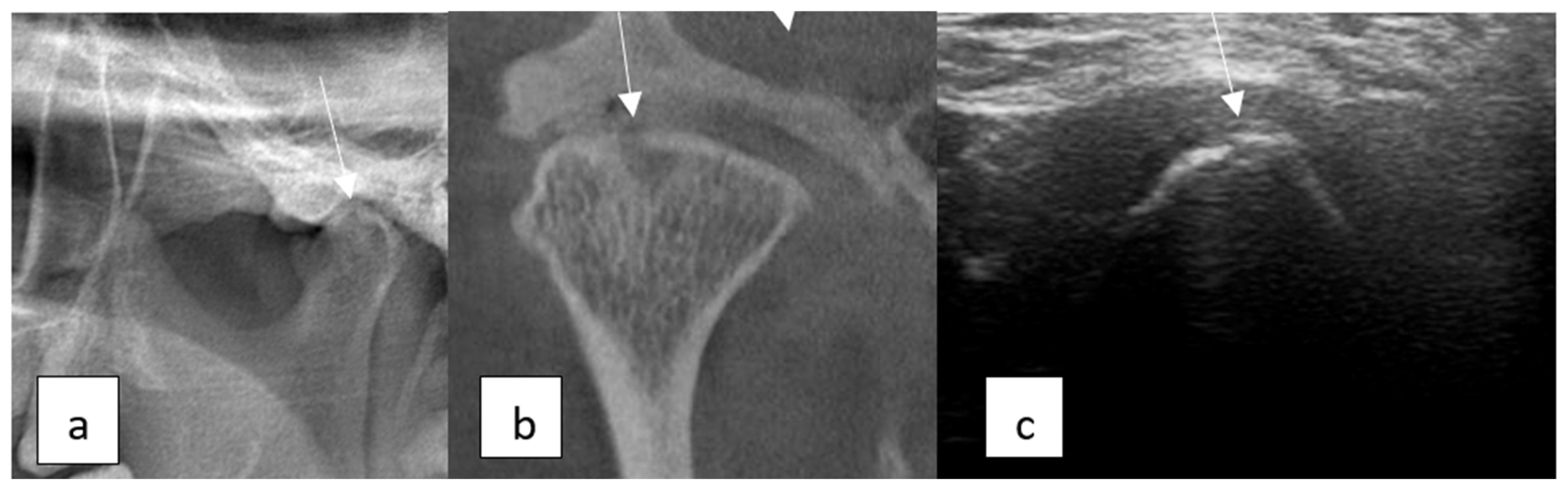 Diagnostics 15 01160 g004