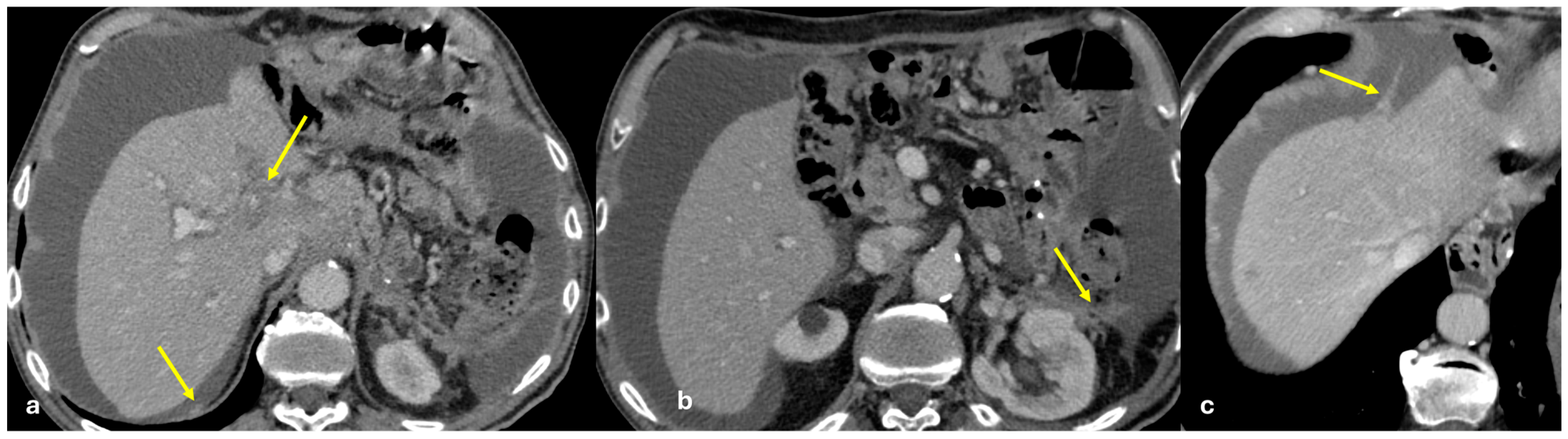 Diagnostics 15 01163 g001