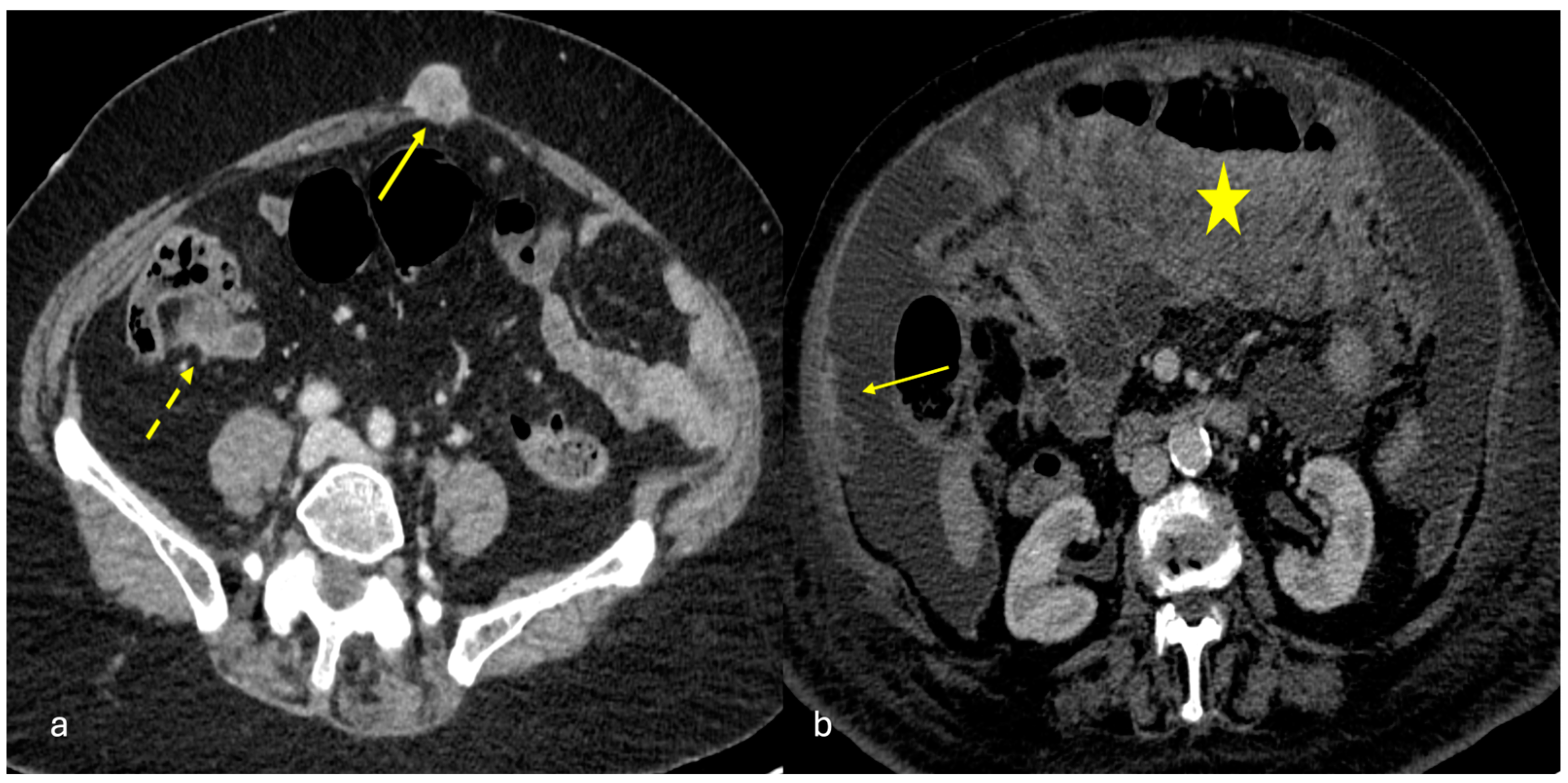 Diagnostics 15 01163 g002