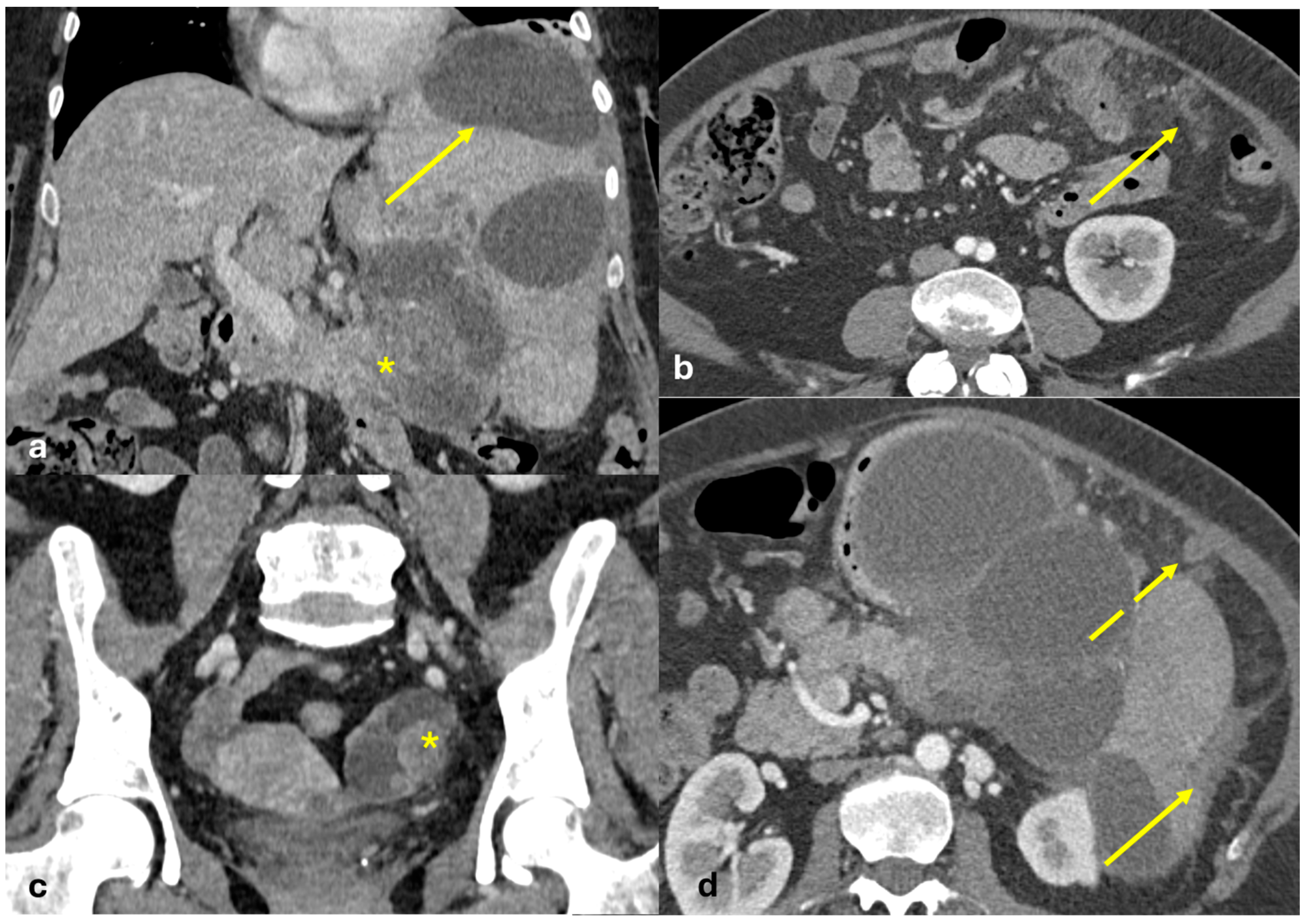 Diagnostics 15 01163 g003