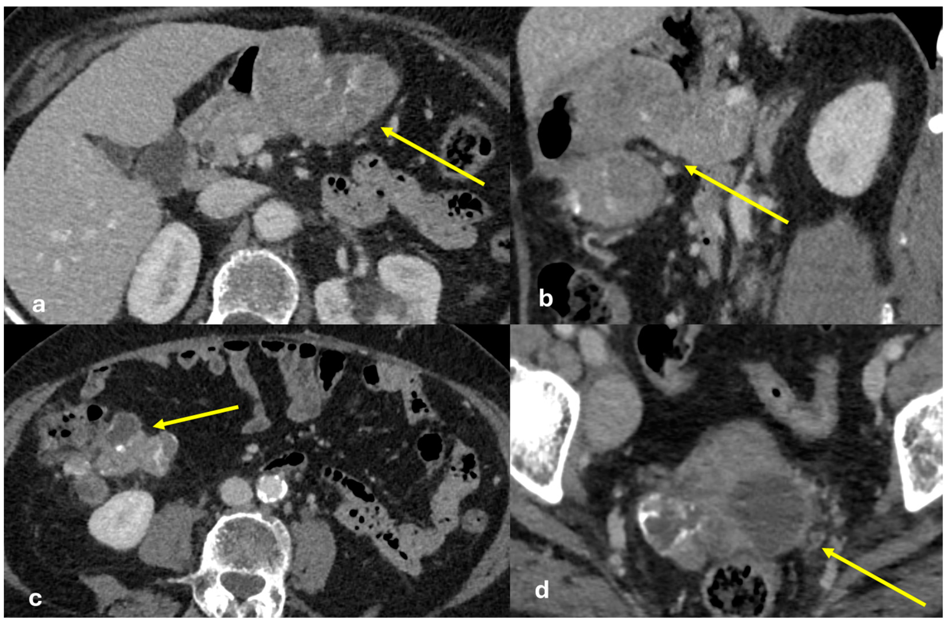 Diagnostics 15 01163 g004