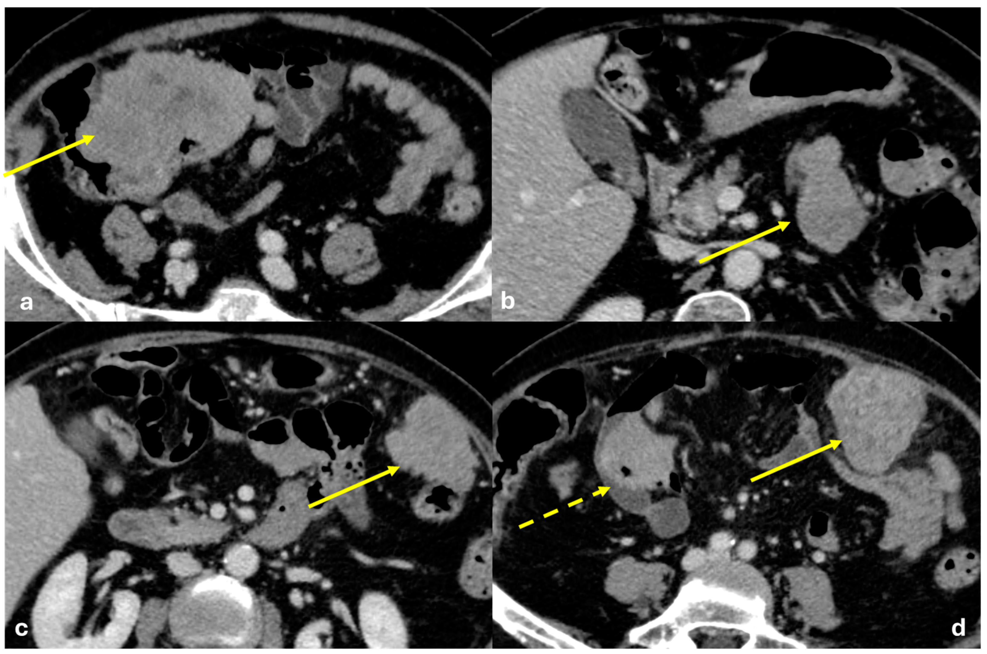 Diagnostics 15 01163 g005
