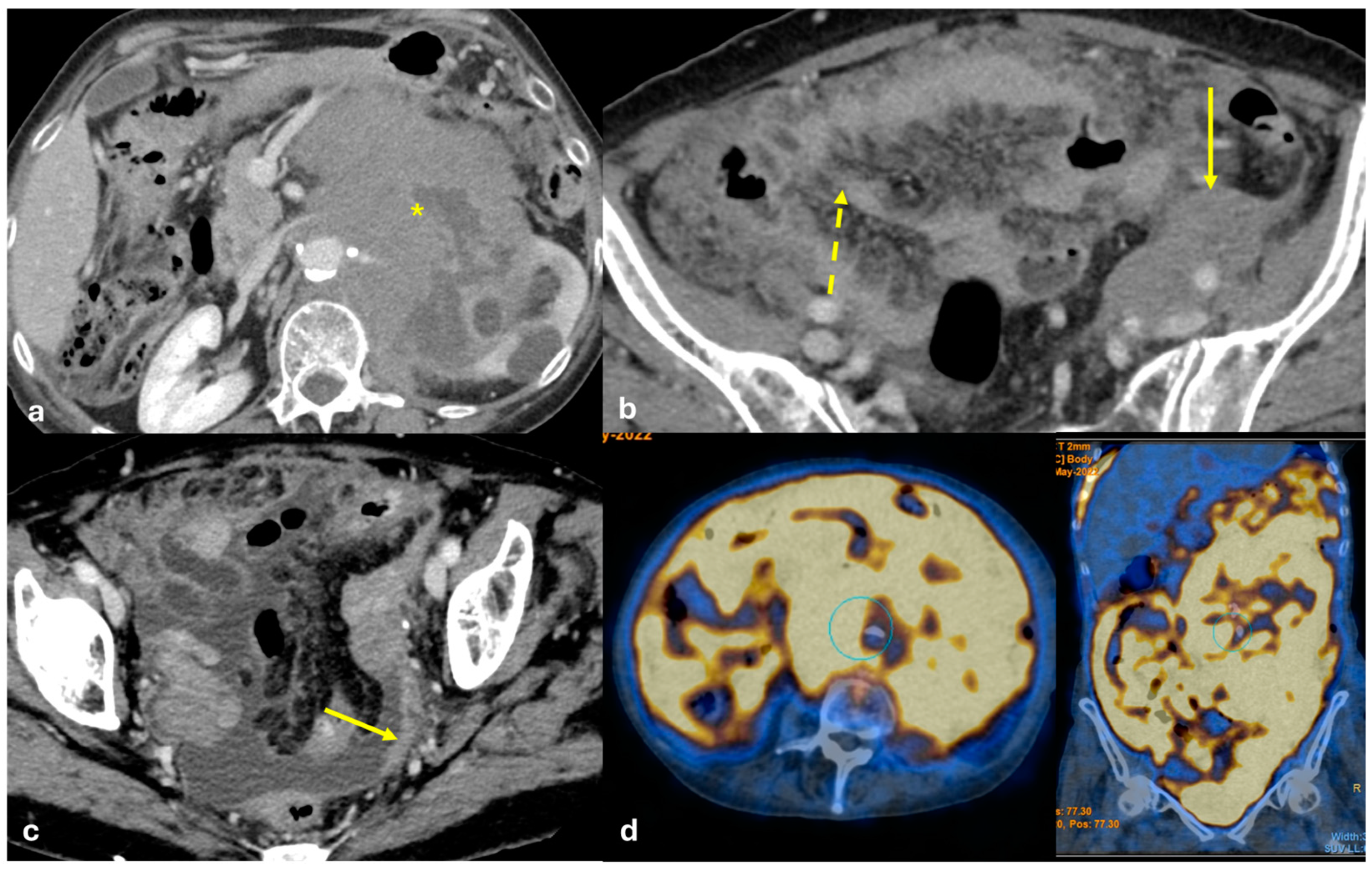 Diagnostics 15 01163 g008