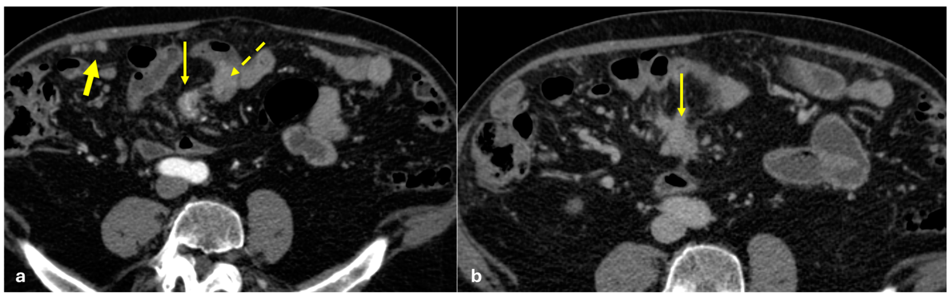 Diagnostics 15 01163 g009