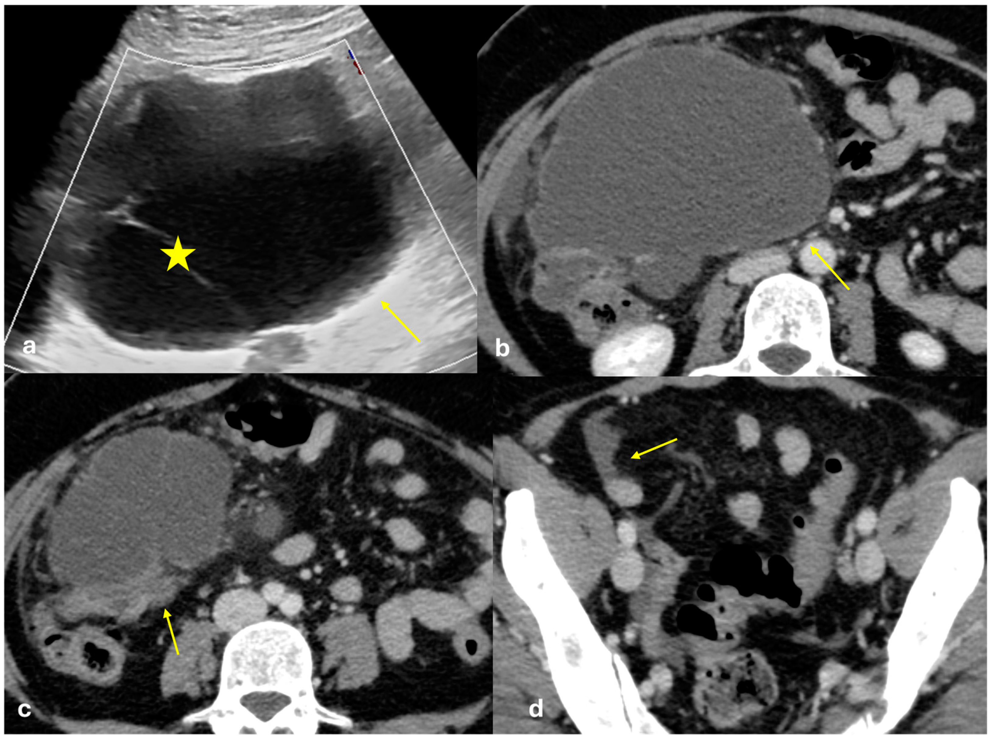 Diagnostics 15 01163 g010