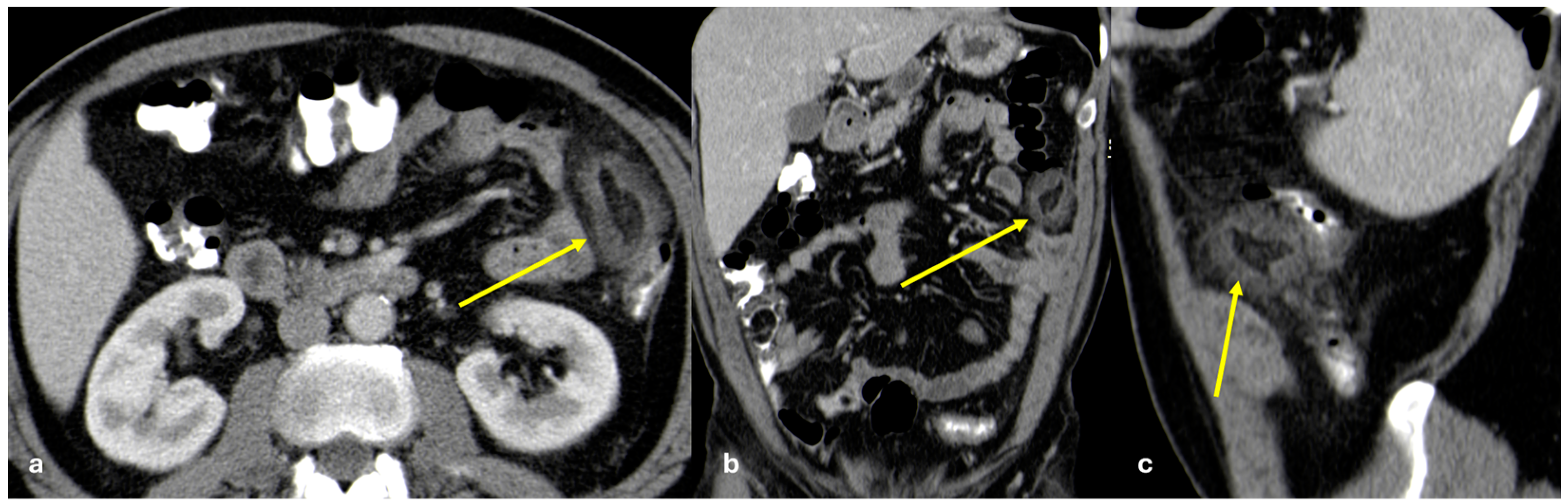 Diagnostics 15 01163 g011
