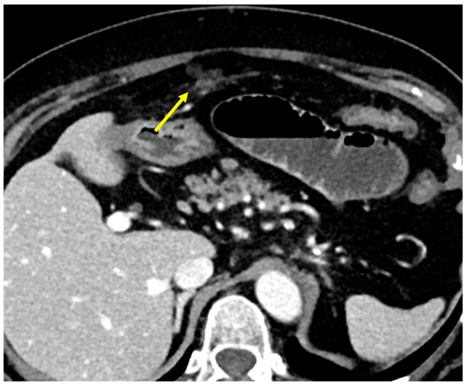 Diagnostics 15 01163 g012