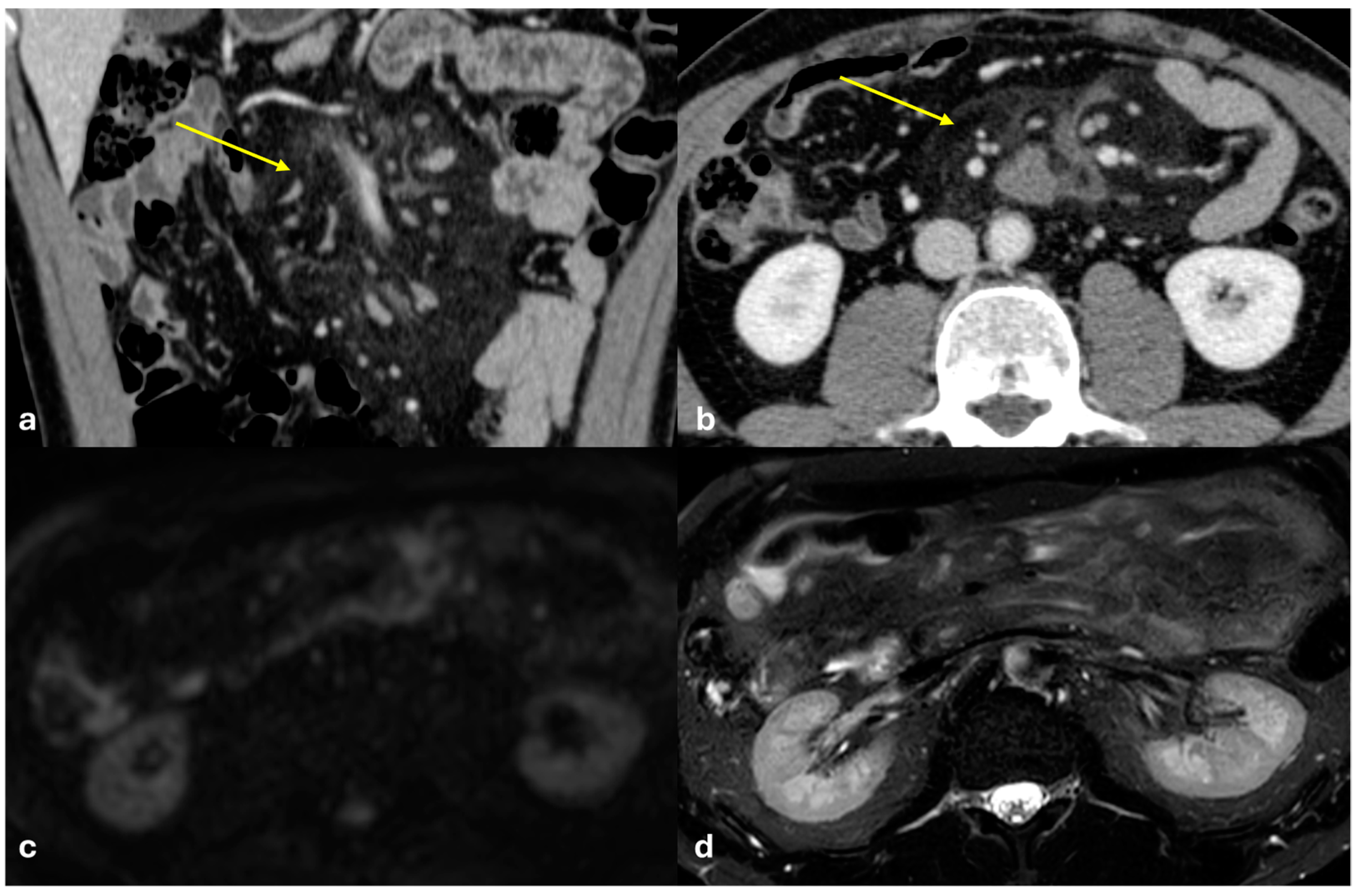 Diagnostics 15 01163 g013