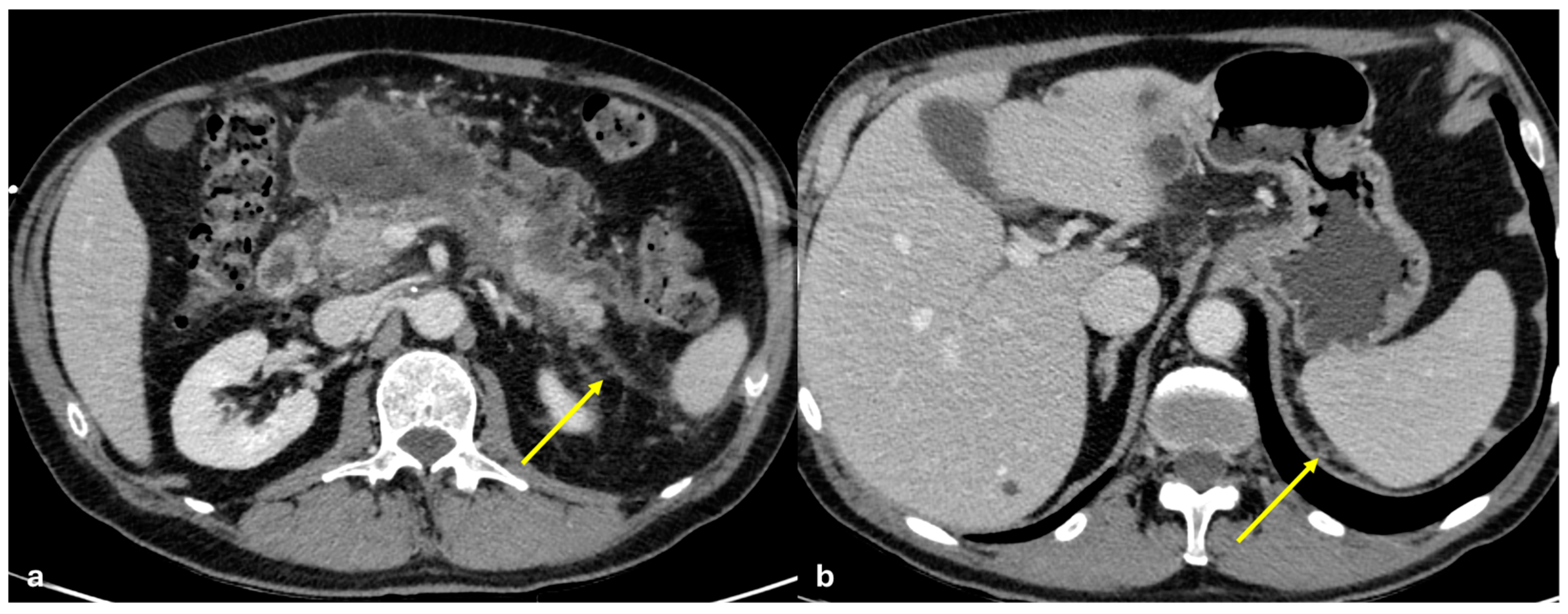 Diagnostics 15 01163 g014
