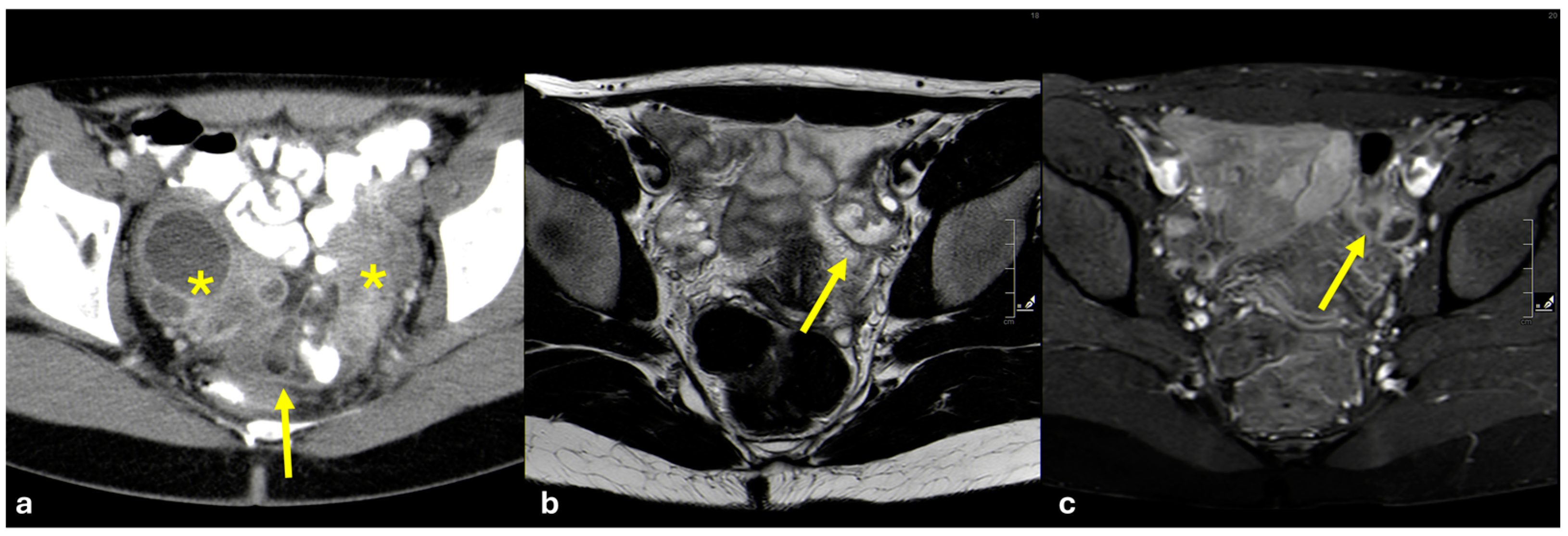 Diagnostics 15 01163 g015