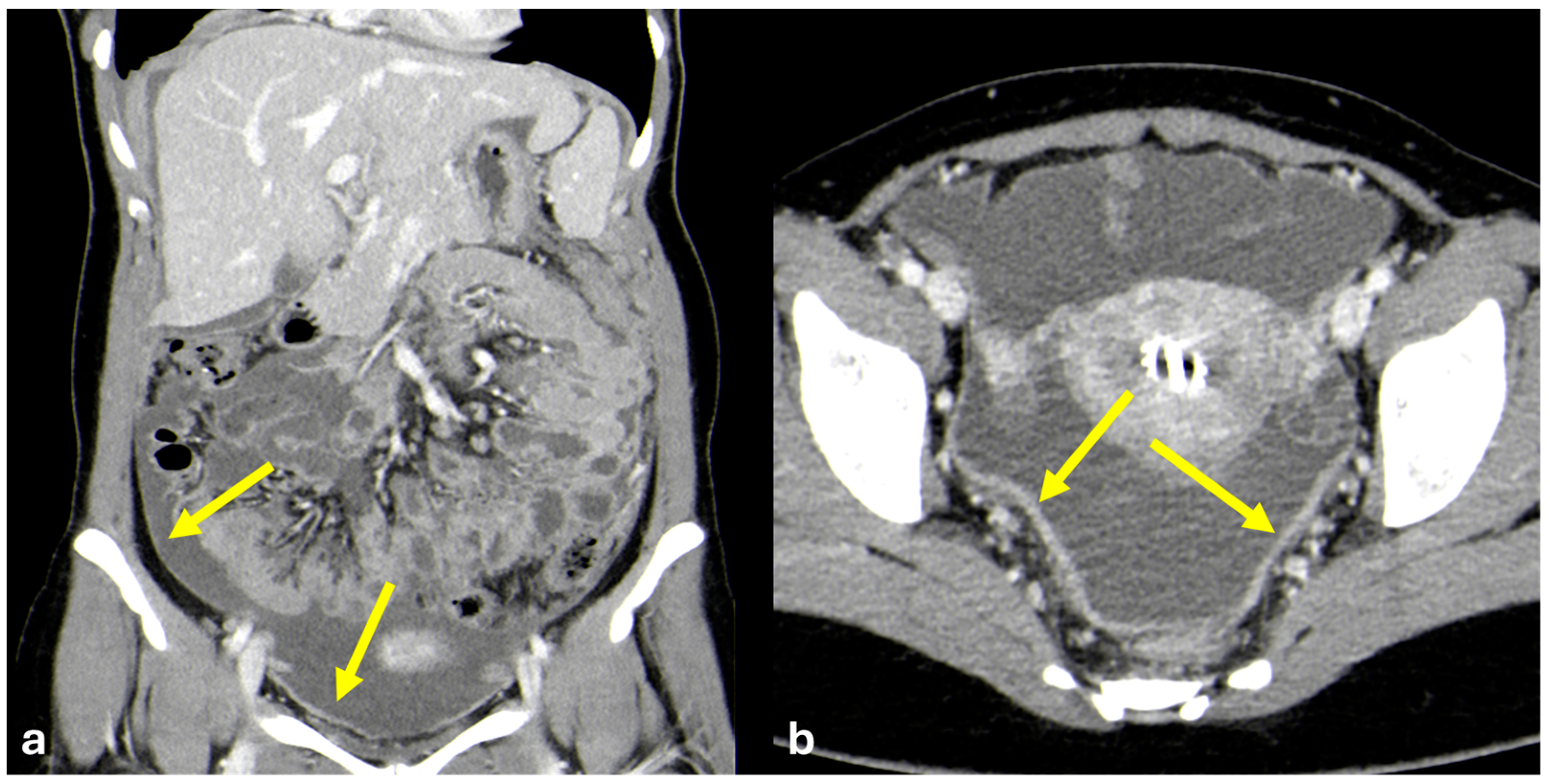 Diagnostics 15 01163 g016