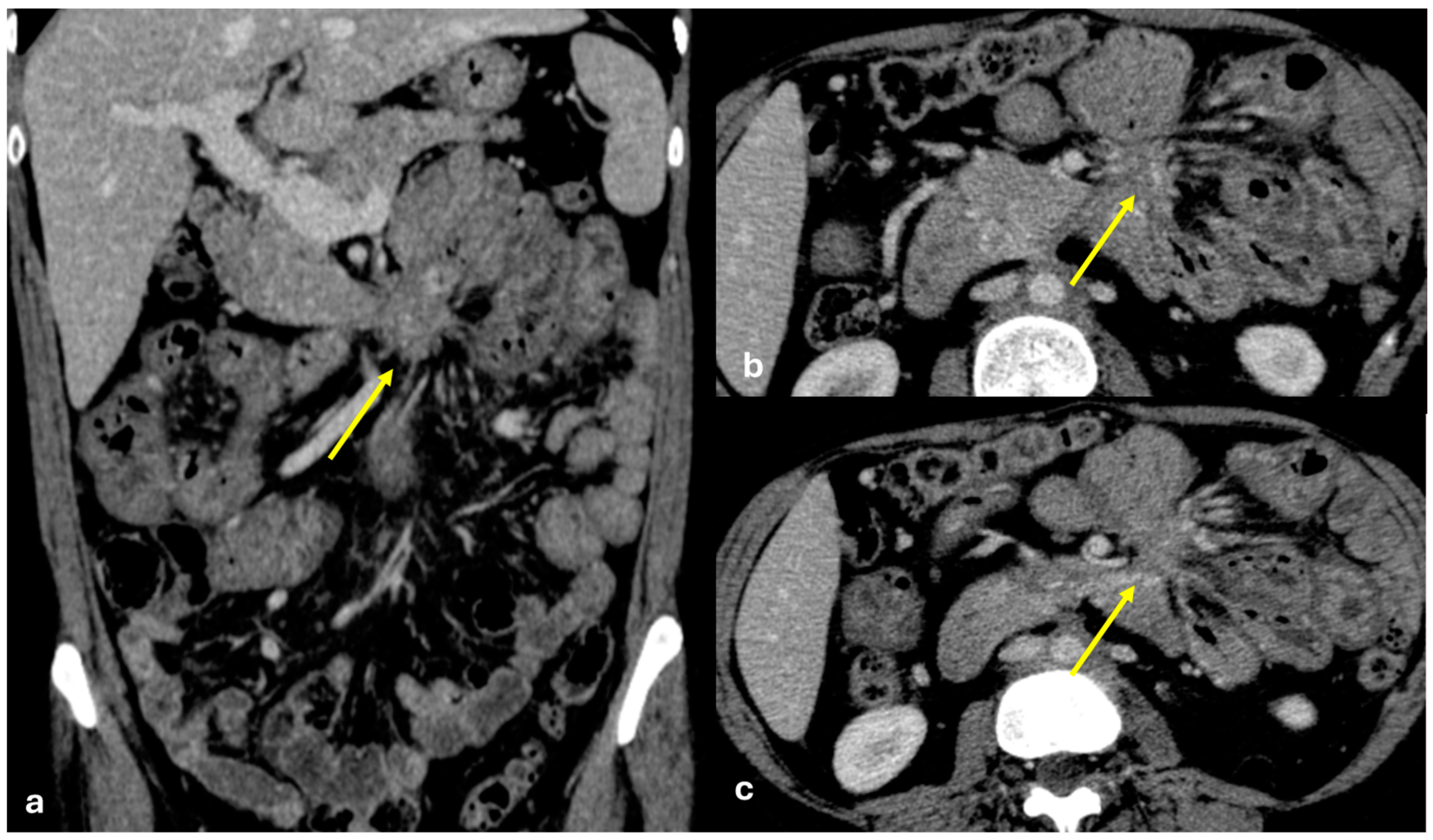 Diagnostics 15 01163 g017