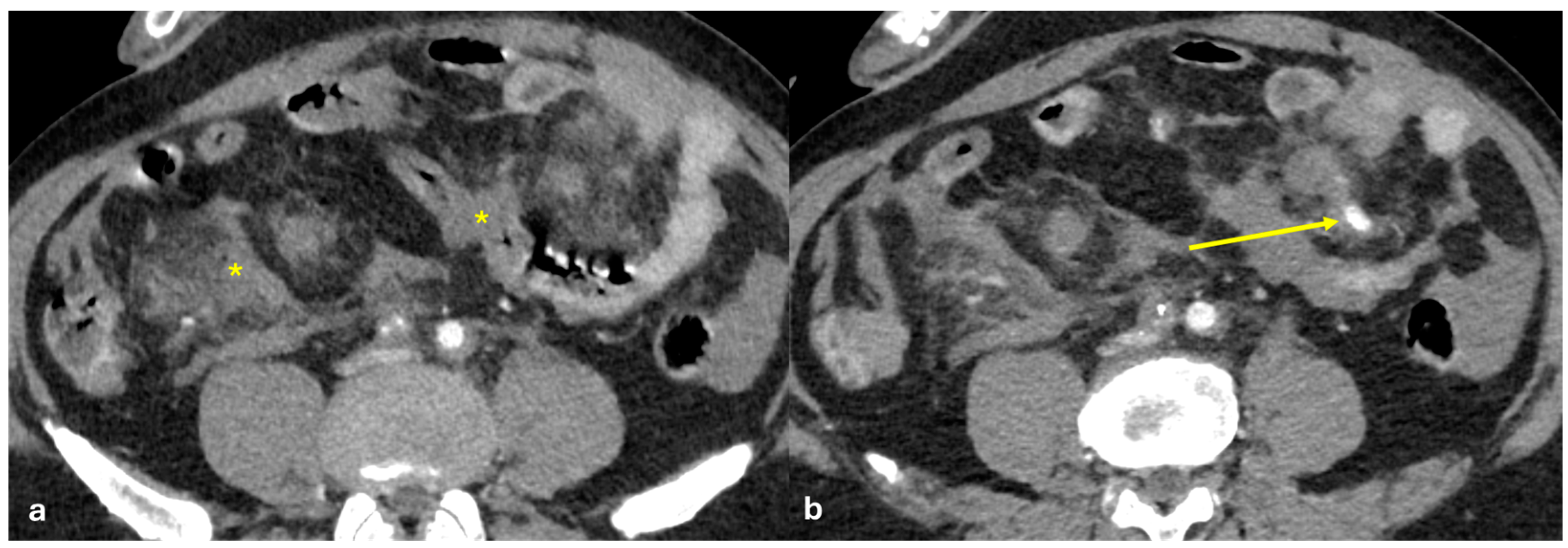 Diagnostics 15 01163 g018
