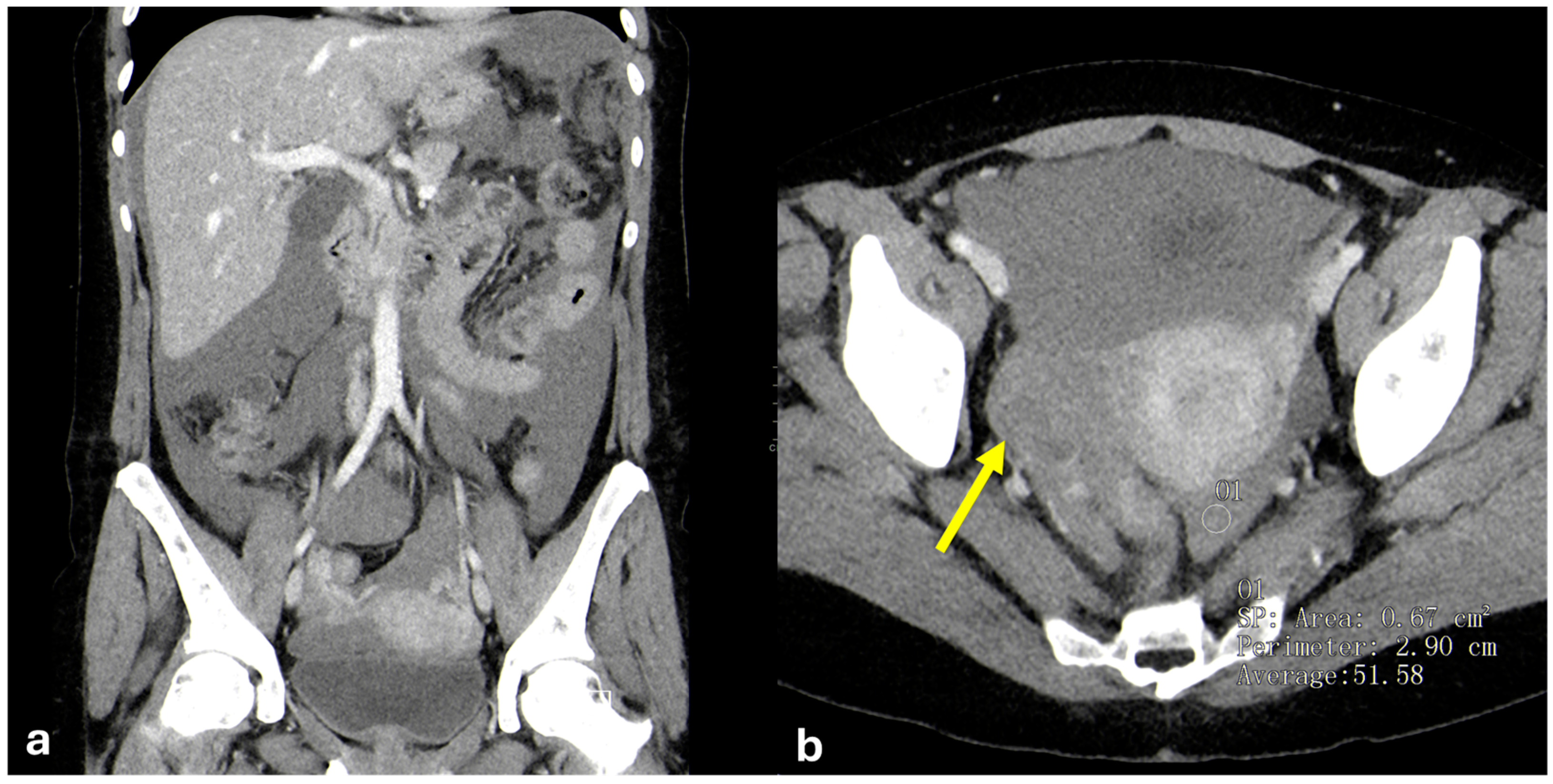 Diagnostics 15 01163 g019