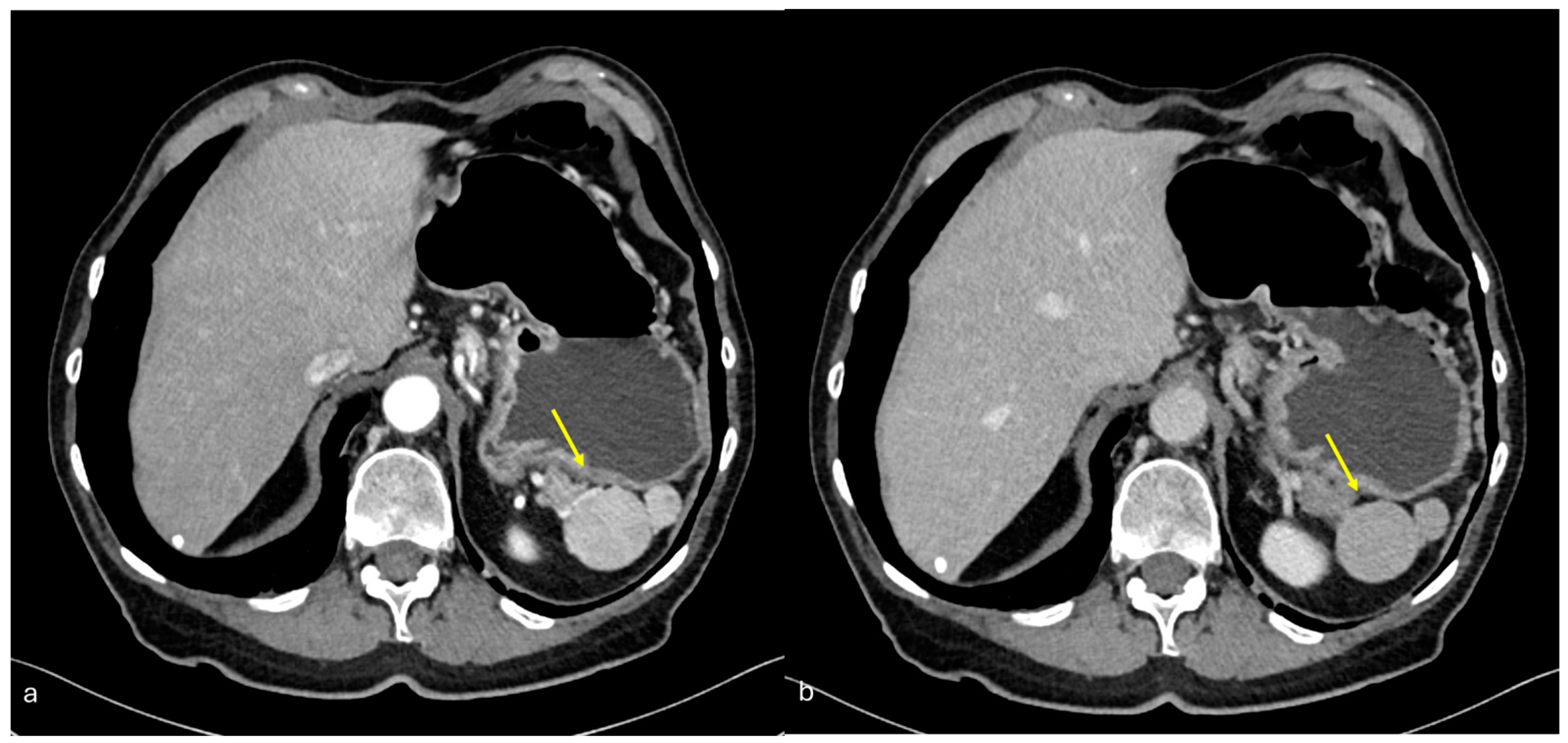 Diagnostics 15 01163 g020