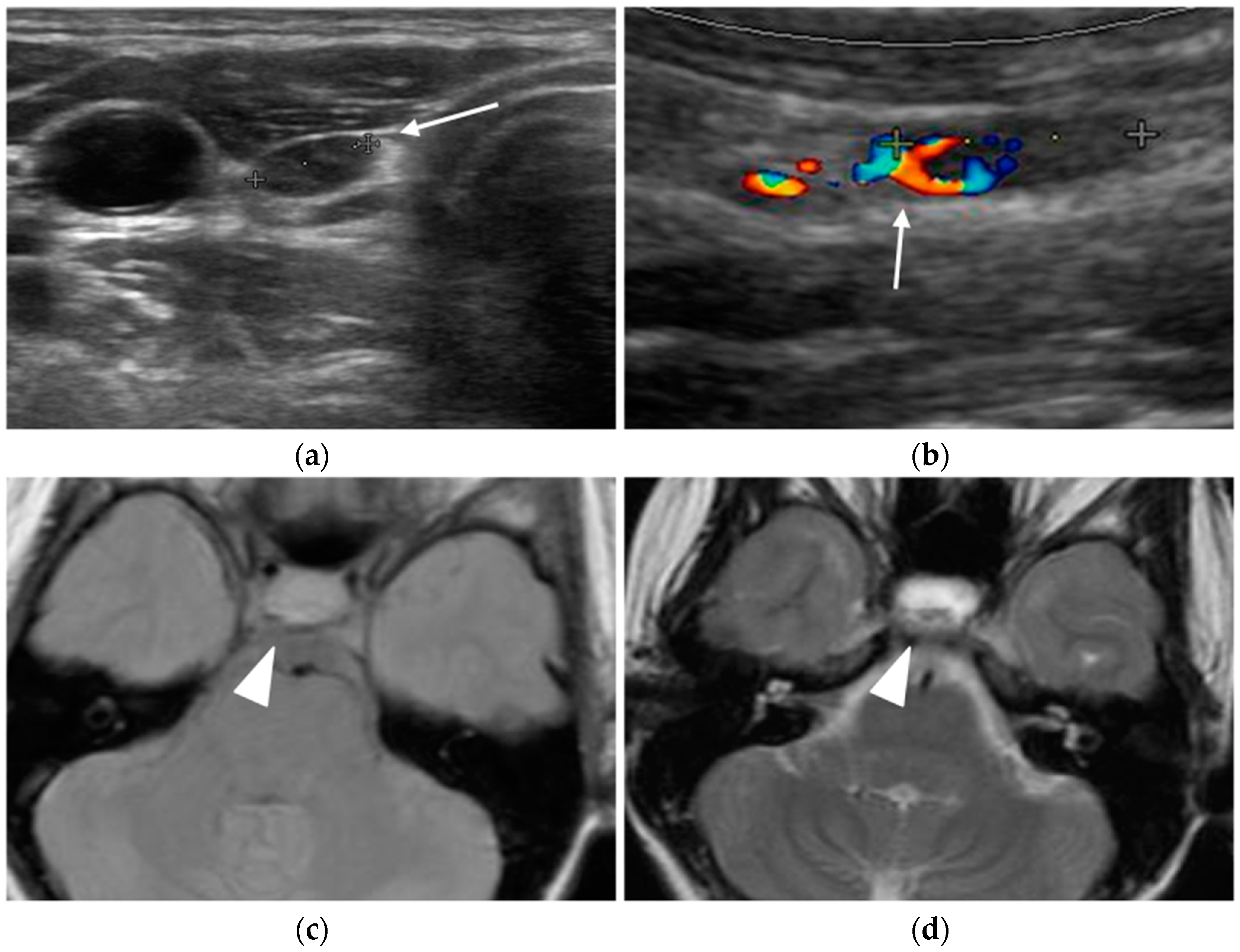 Diagnostics 15 01164 g001a Diagnostics 15 01164 g001a