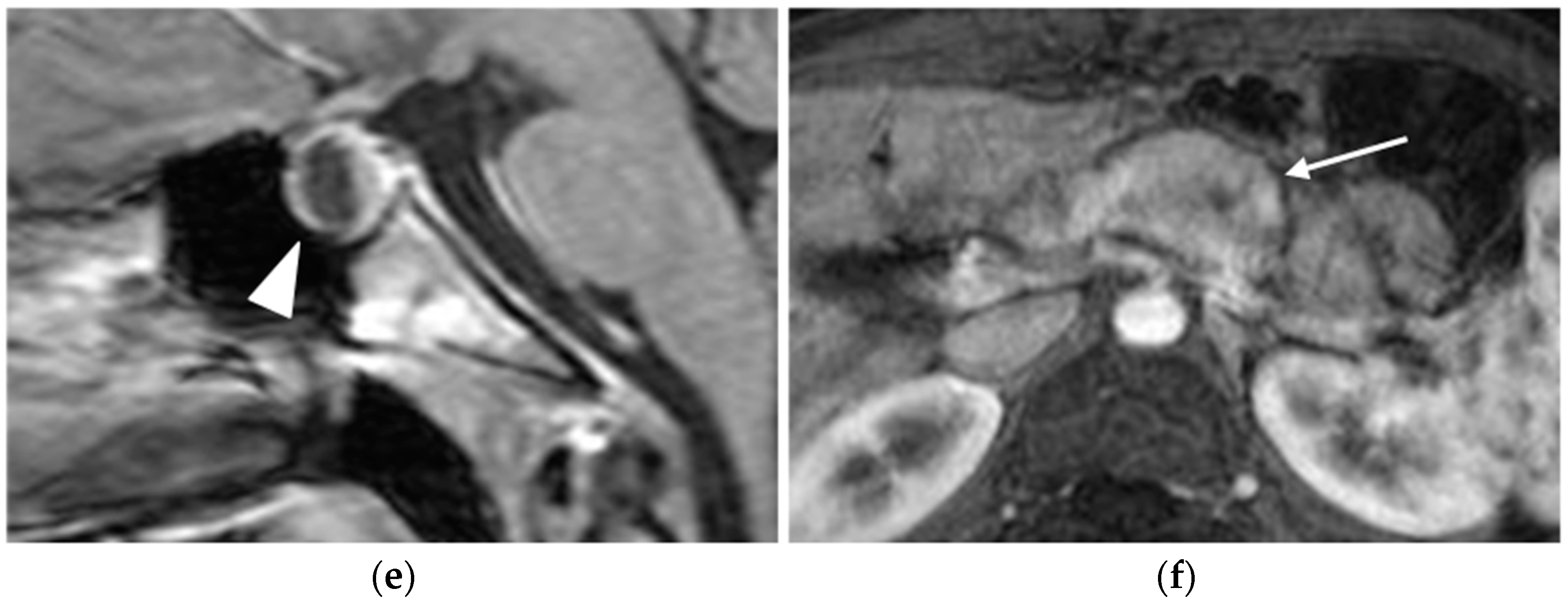 Diagnostics 15 01164 g001b Diagnostics 15 01164 g001b