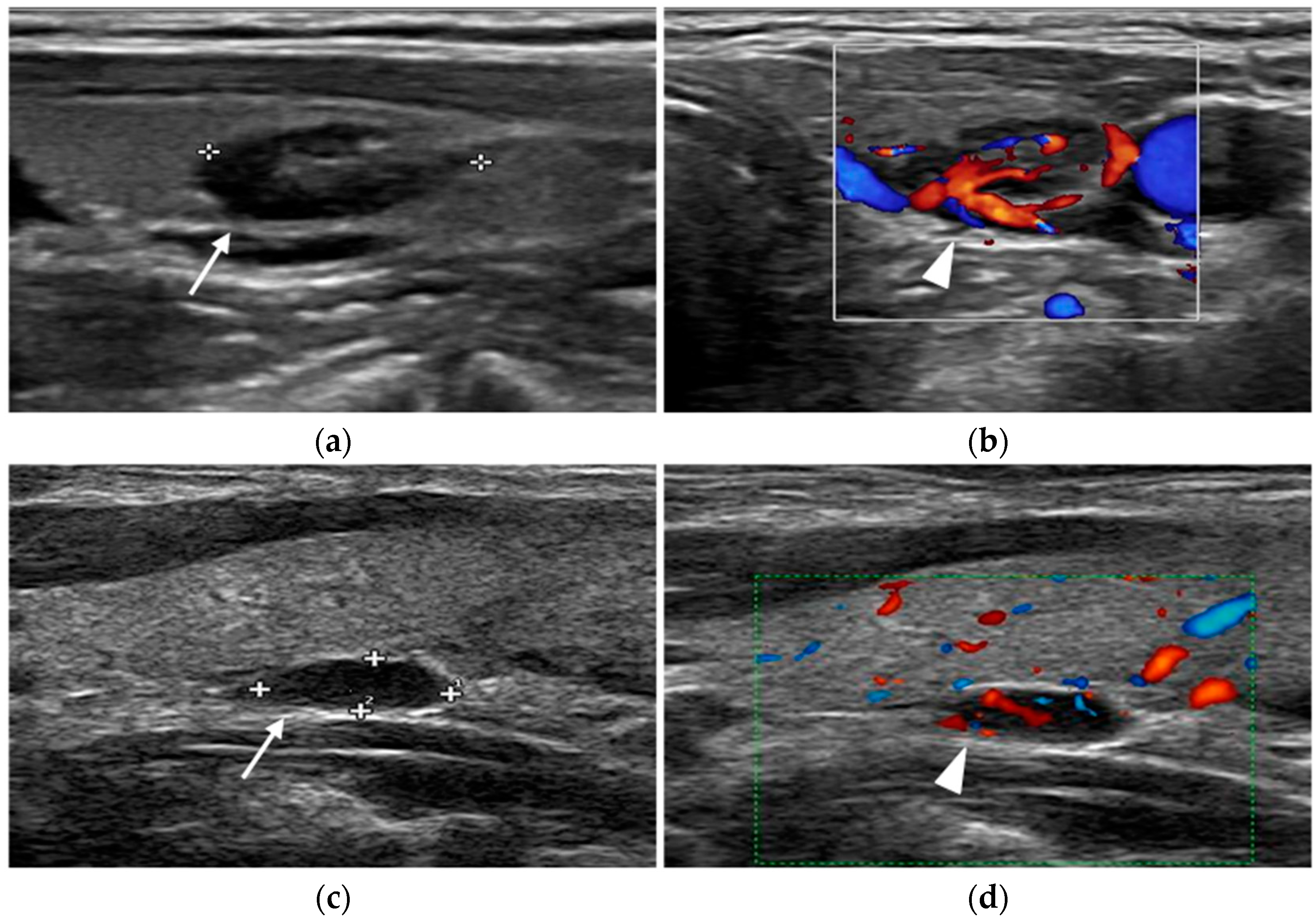 Diagnostics 15 01164 g002 Diagnostics 15 01164 g002