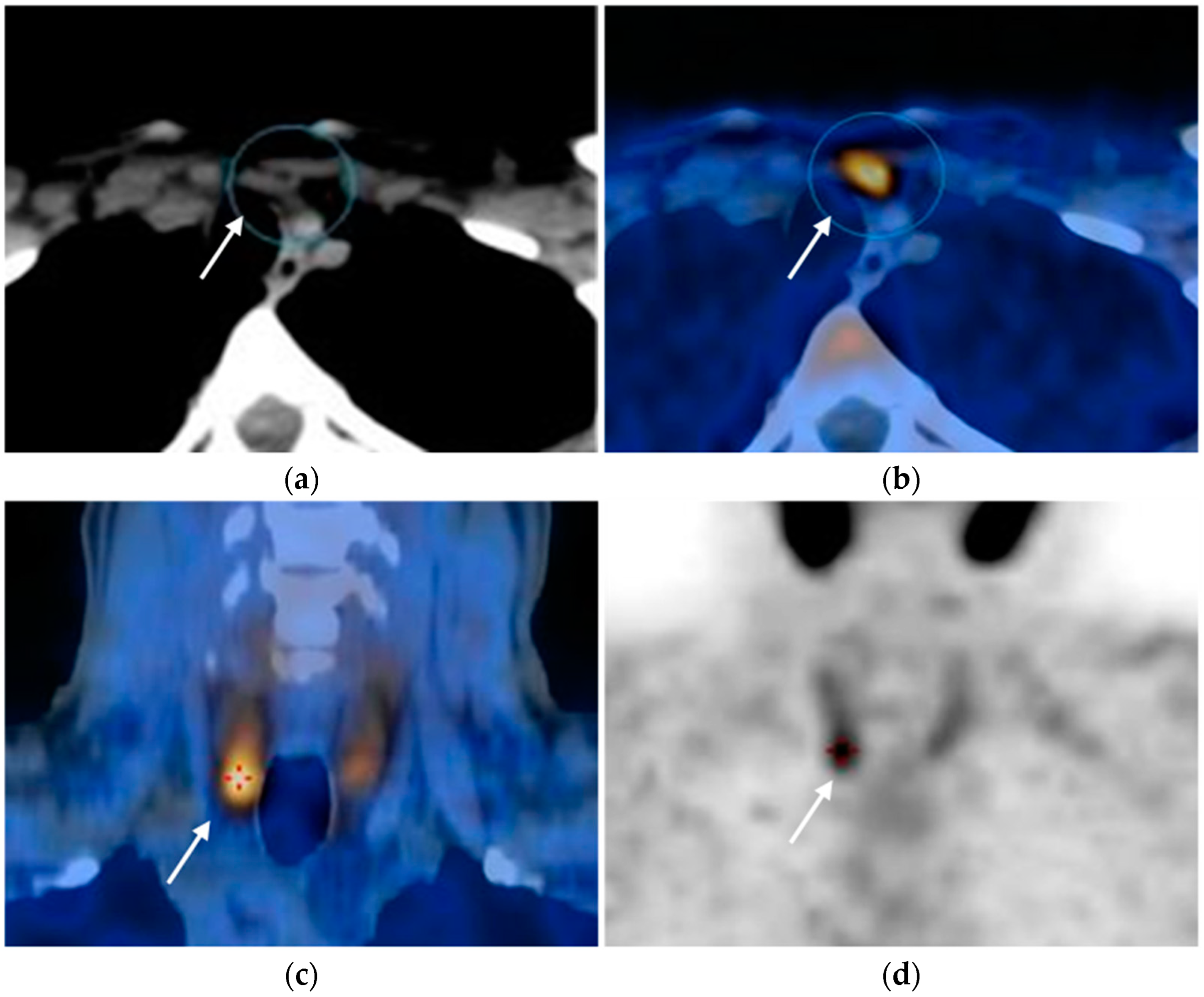 Diagnostics 15 01164 g003 Diagnostics 15 01164 g003