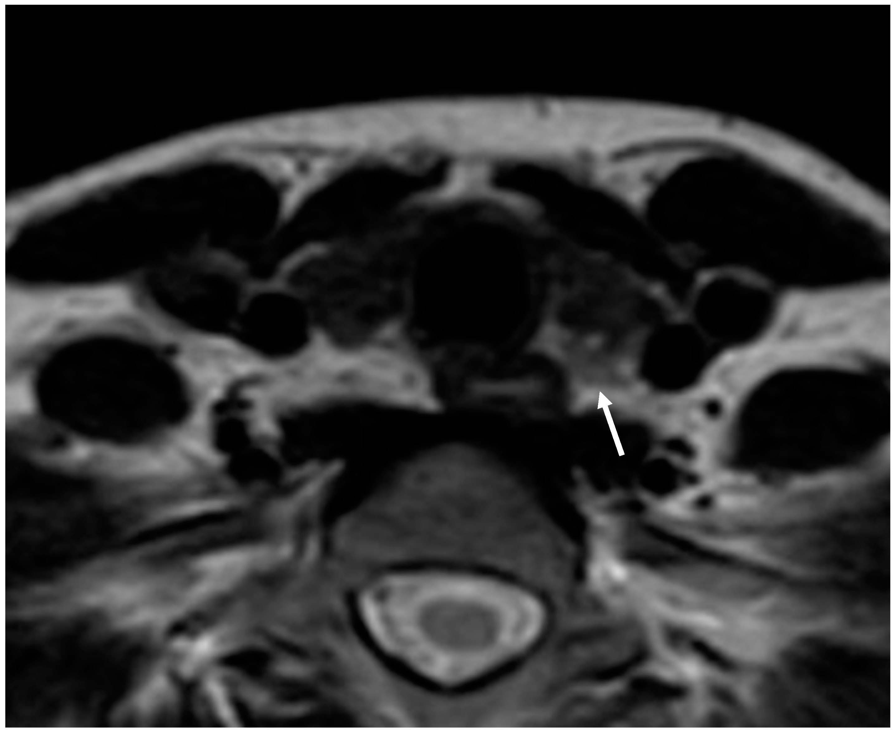 Diagnostics 15 01164 g004 Diagnostics 15 01164 g004