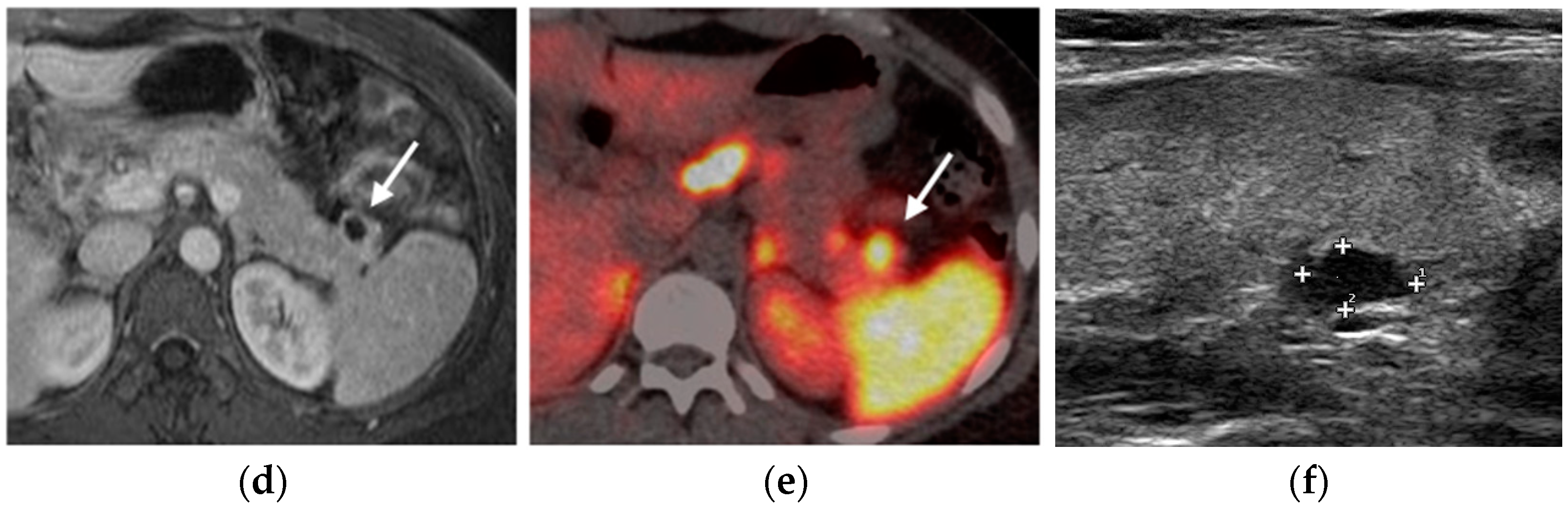 Diagnostics 15 01164 g005b Diagnostics 15 01164 g005b
