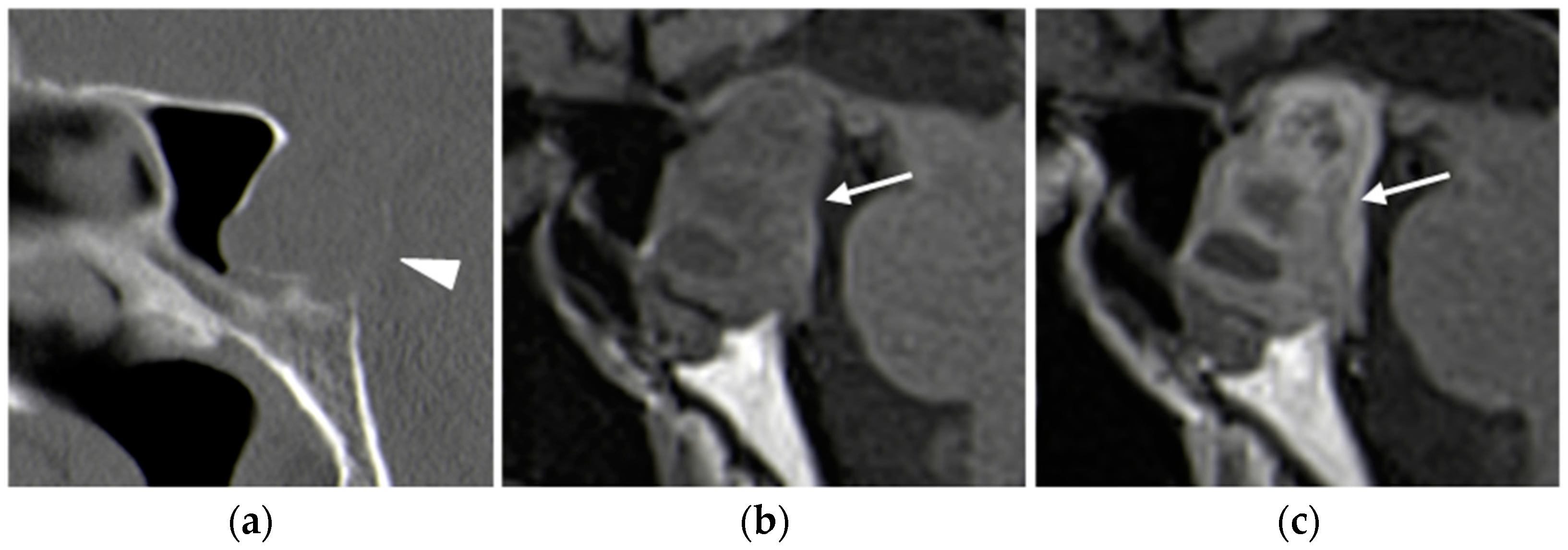 Diagnostics 15 01164 g009 Diagnostics 15 01164 g009