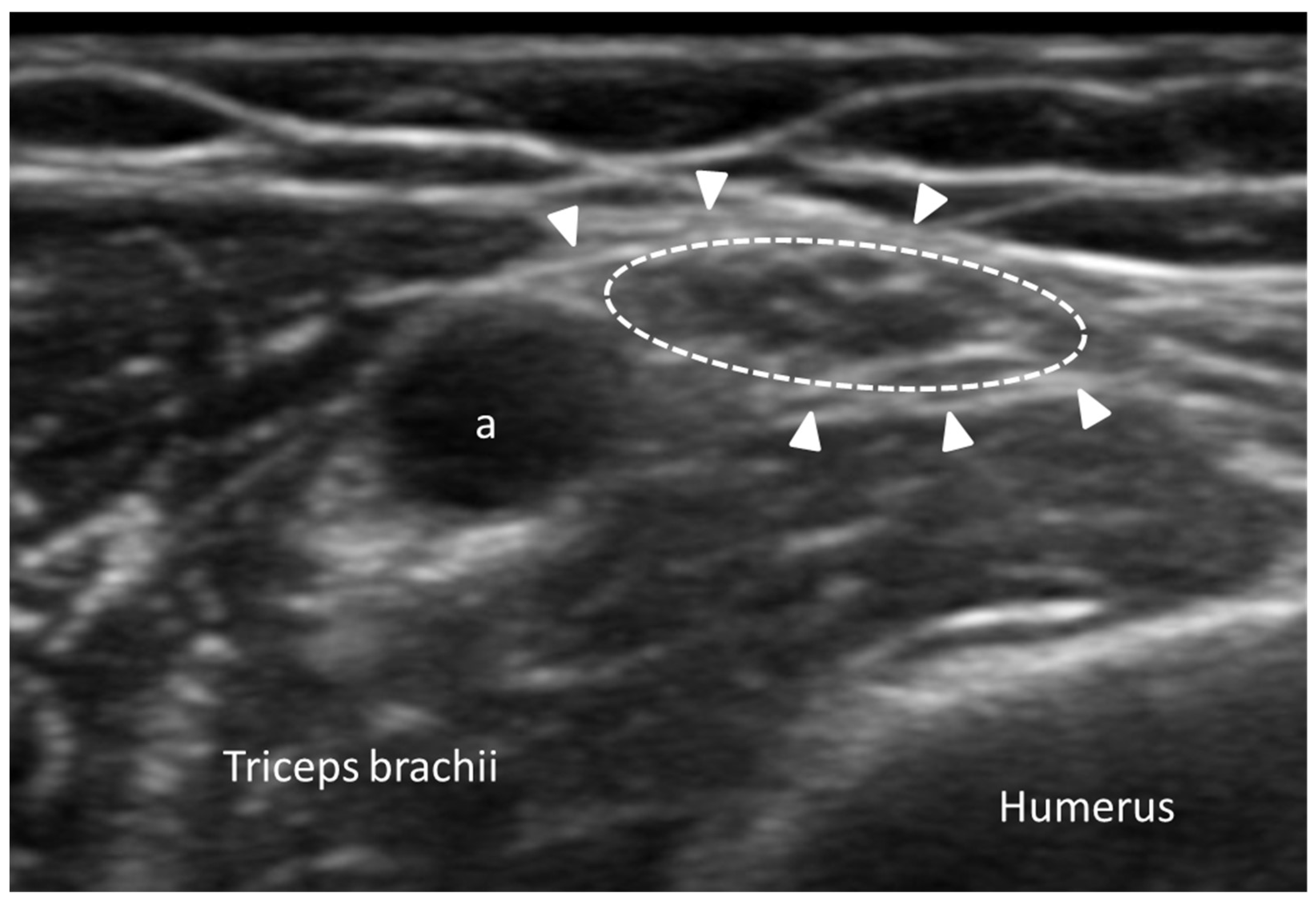 Diagnostics 15 01180 g010