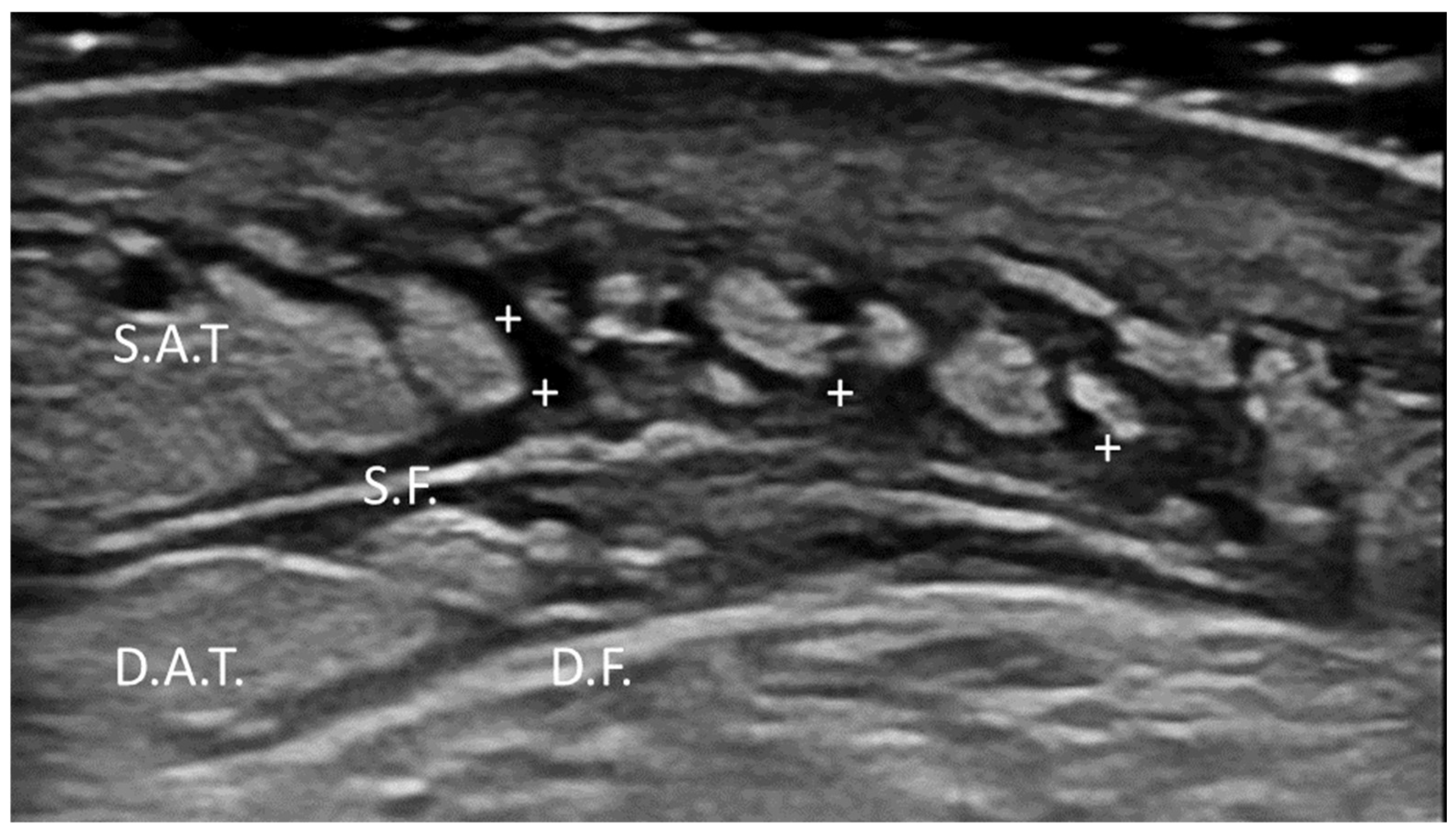 Diagnostics 15 01180 g013