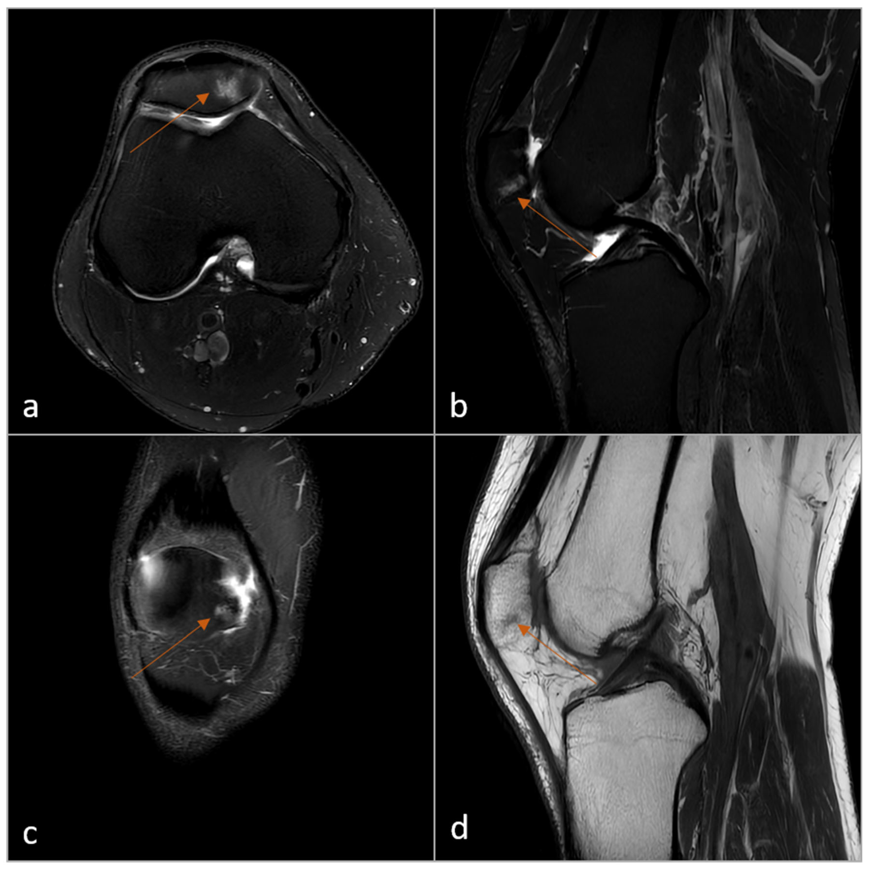 Diagnostics 15 01206 g005