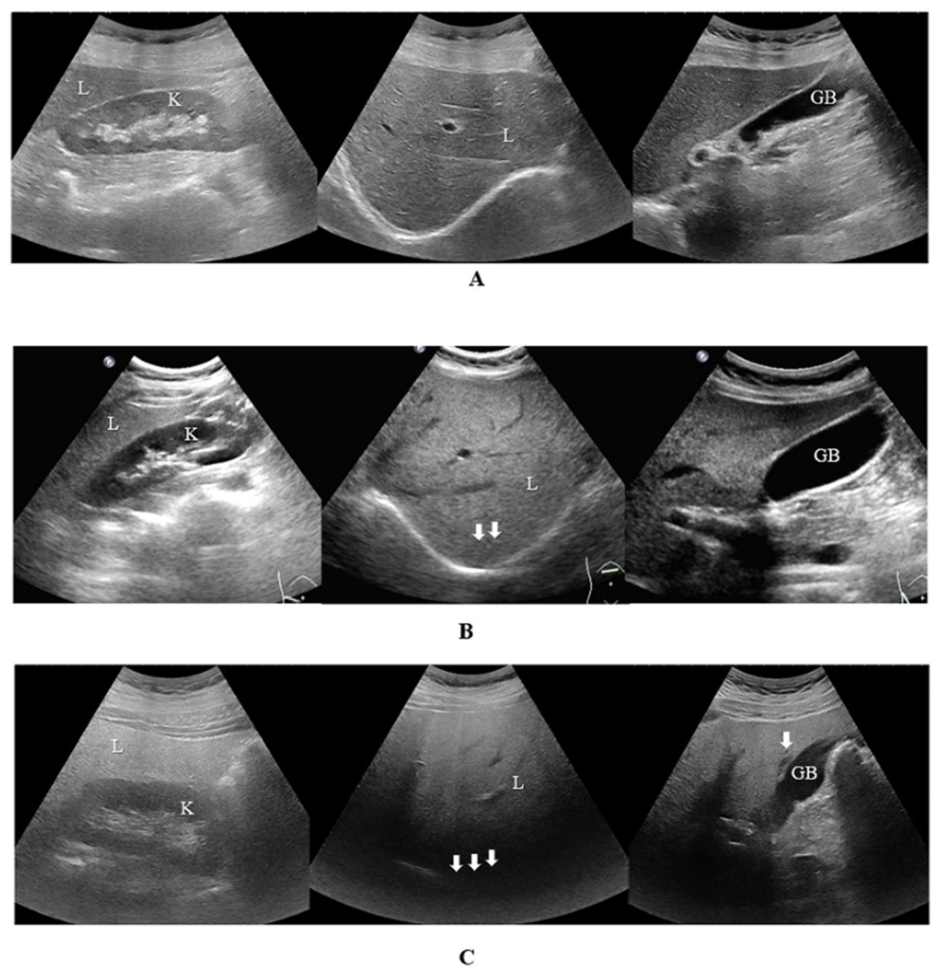 Diagnostics 15 01208 g002