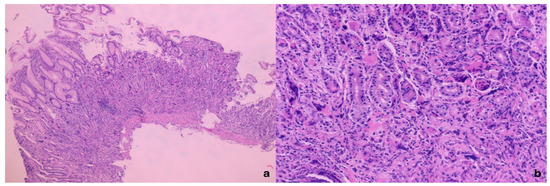 Diagnostics 15 01219 g001