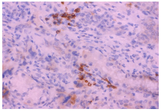 Diagnostics 15 01219 g004