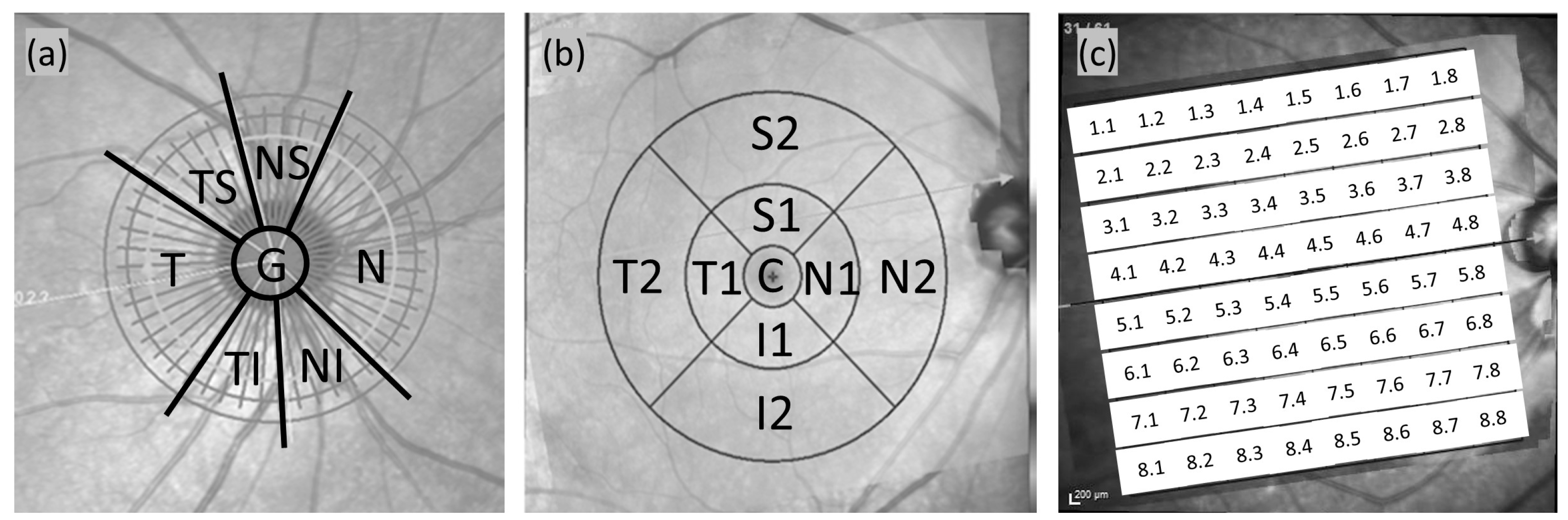 Diagnostics 15 01256 g001