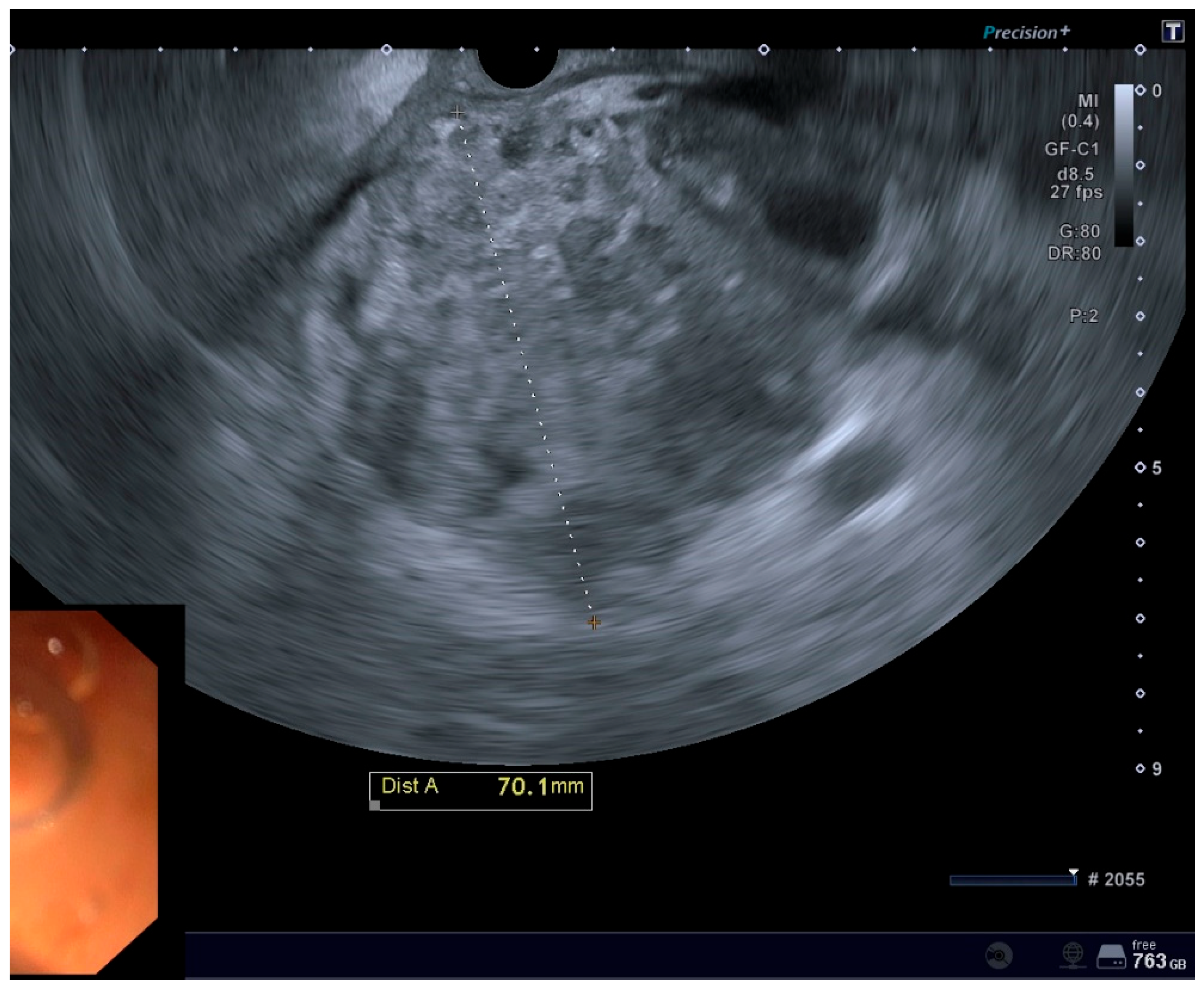 Diagnostics 15 01258 g001