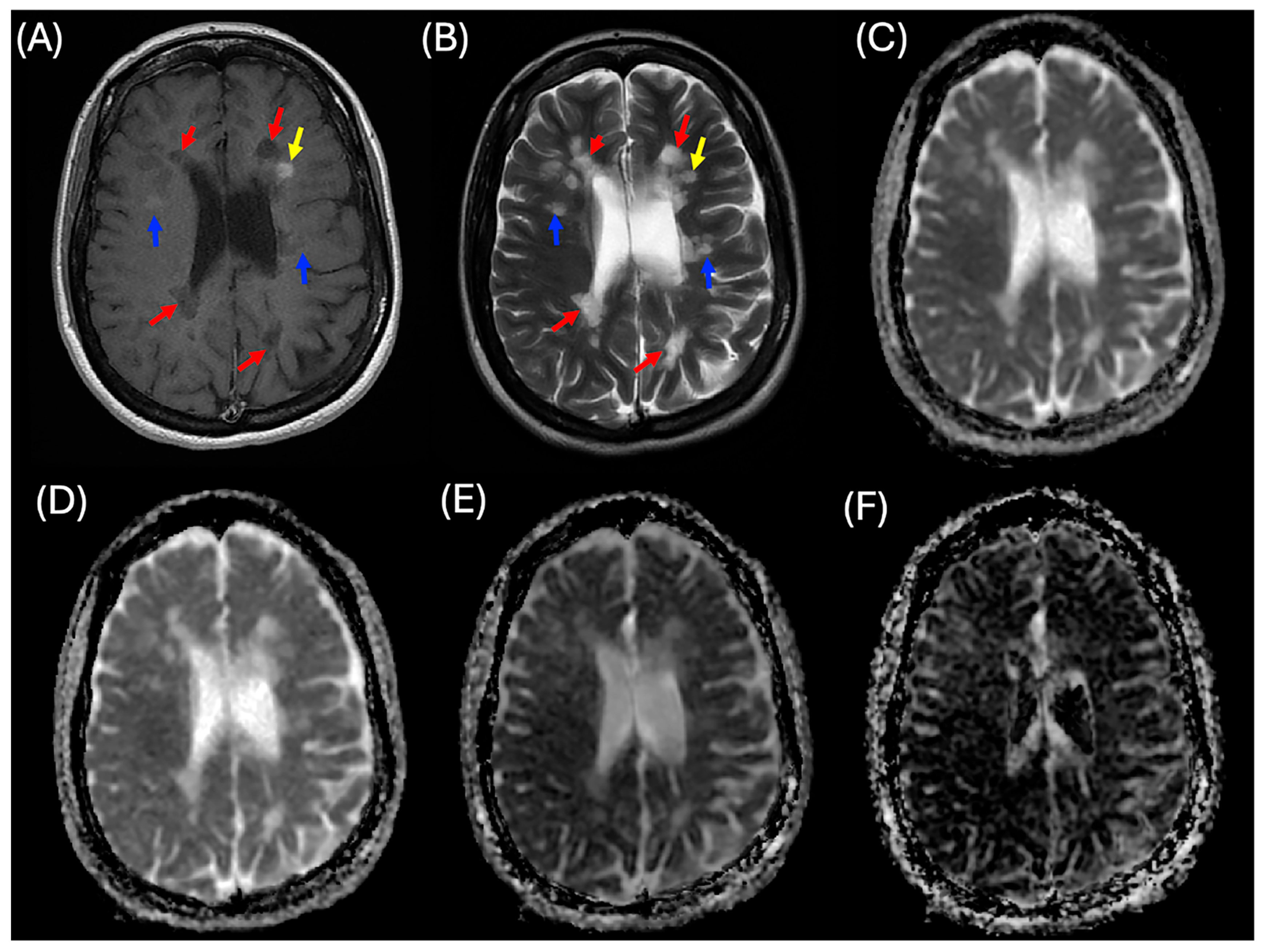 Diagnostics 15 01260 g001