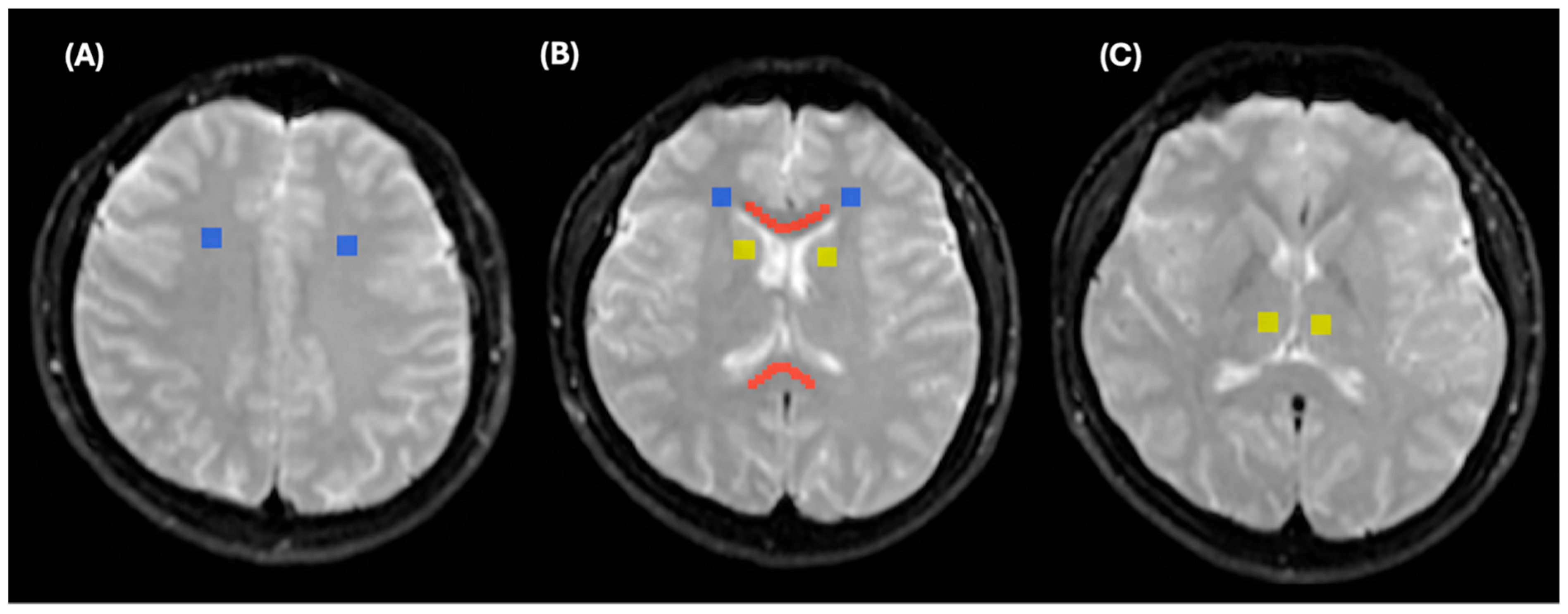 Diagnostics 15 01260 g005