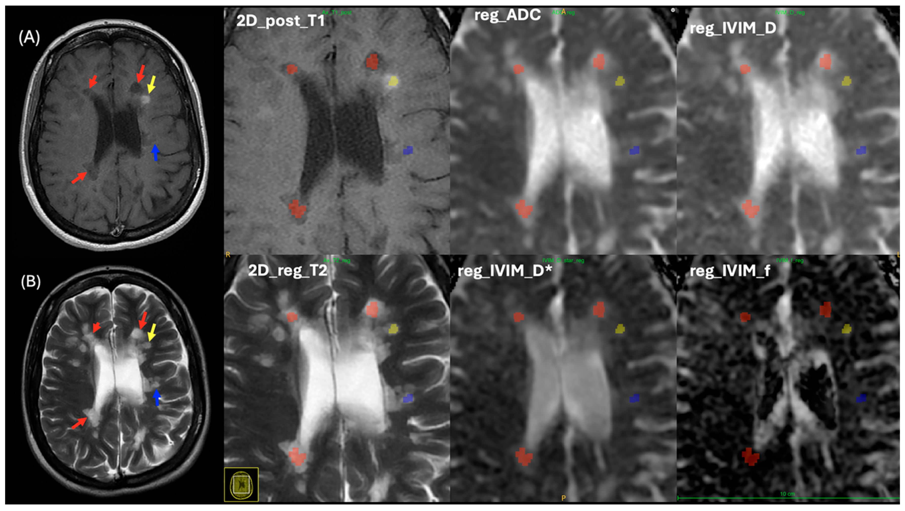 Diagnostics 15 01260 g006