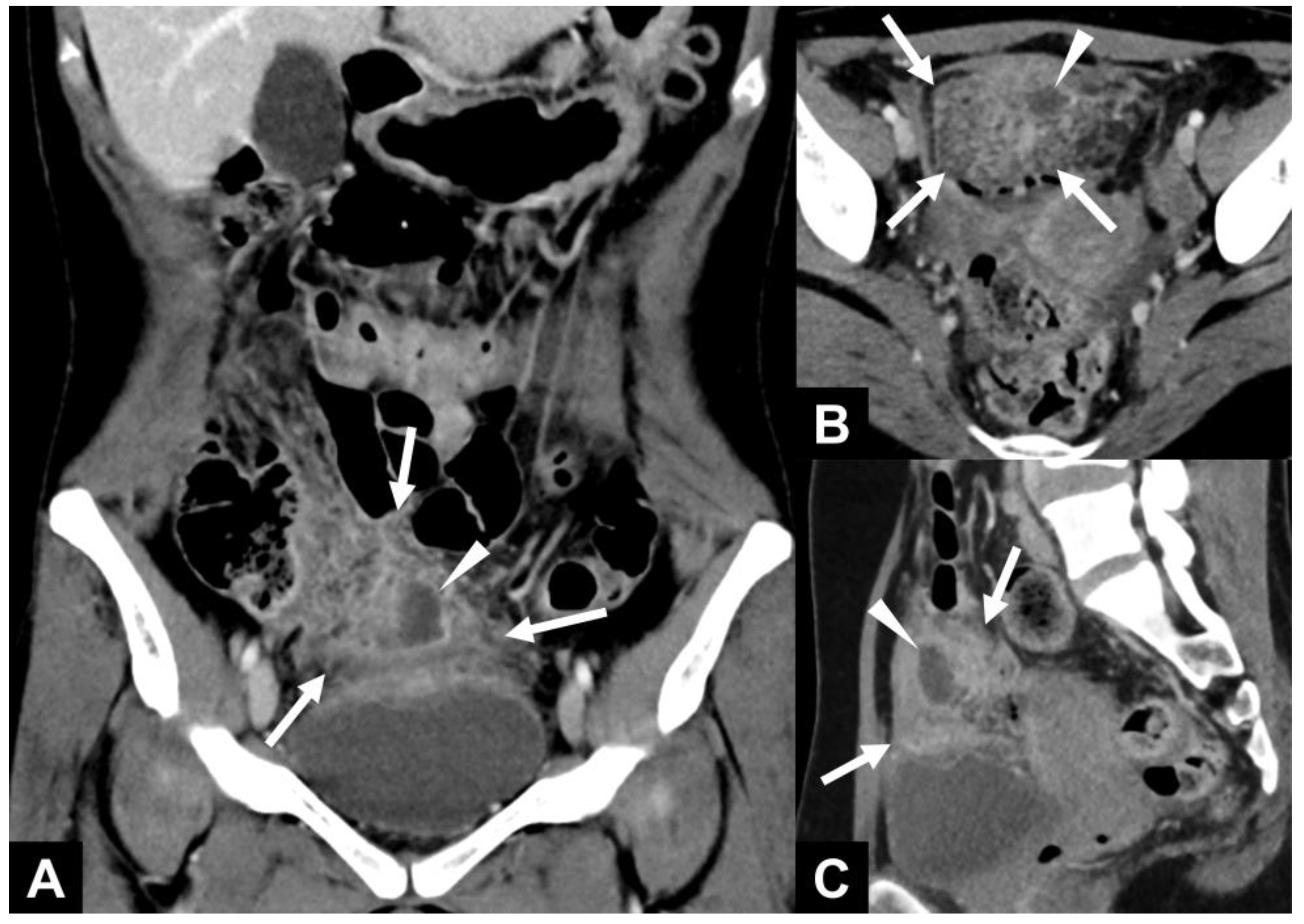 Diagnostics 15 01261 g001