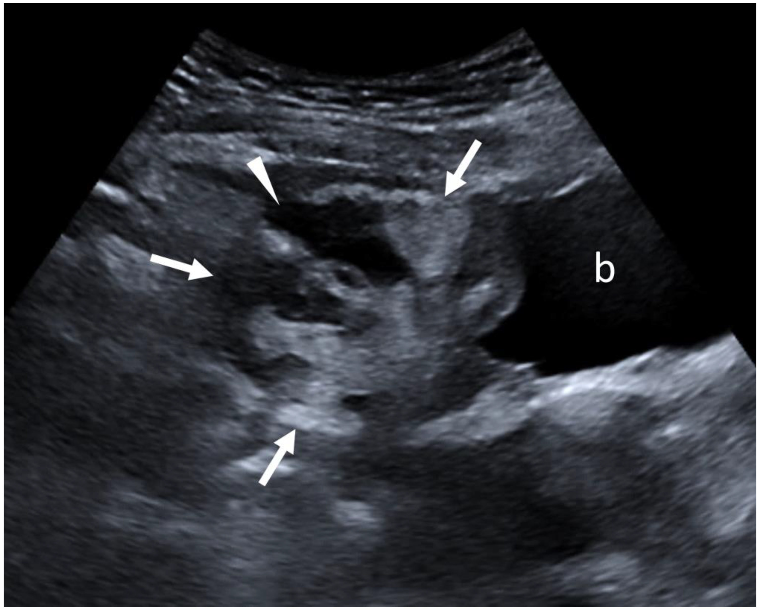 Diagnostics 15 01261 g002